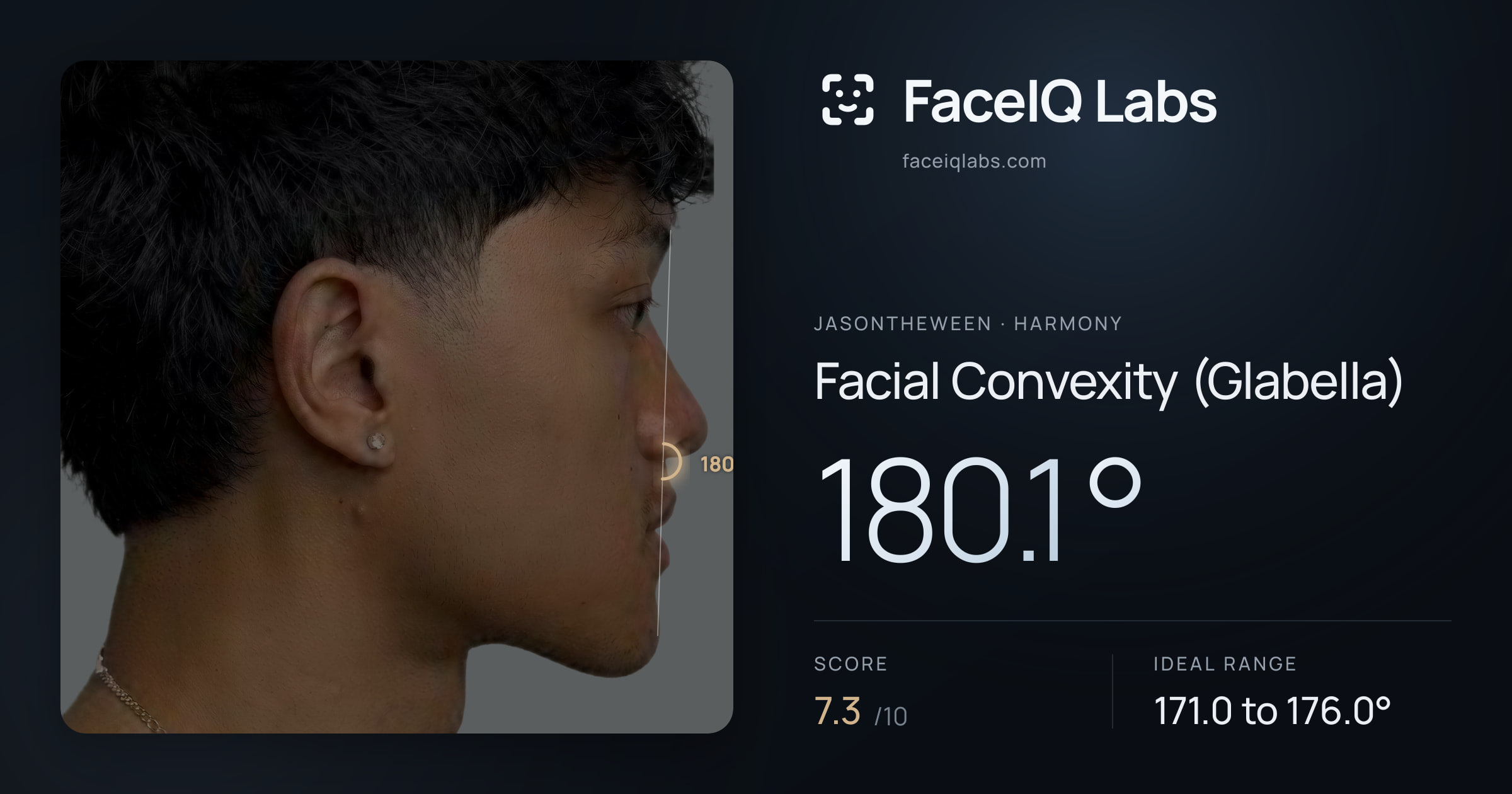 Jasontheween Facial Convexity (Glabella): 180.1°, drawn on the photo