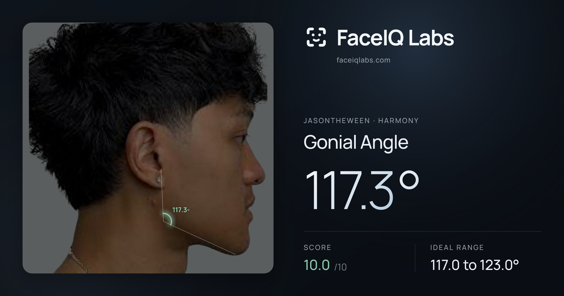 Jasontheween Gonial Angle: 117.3°, drawn on the photo