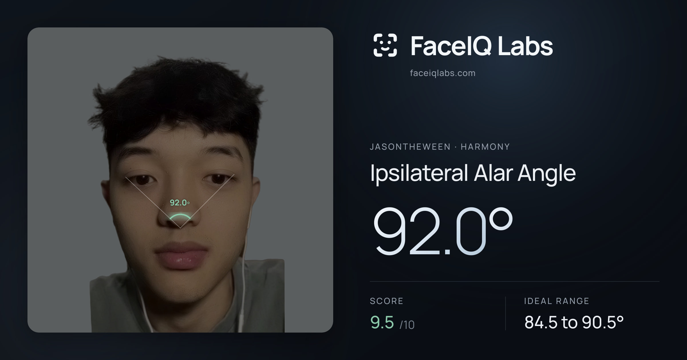 Jasontheween Ipsilateral Alar Angle: 92.0°, drawn on the photo