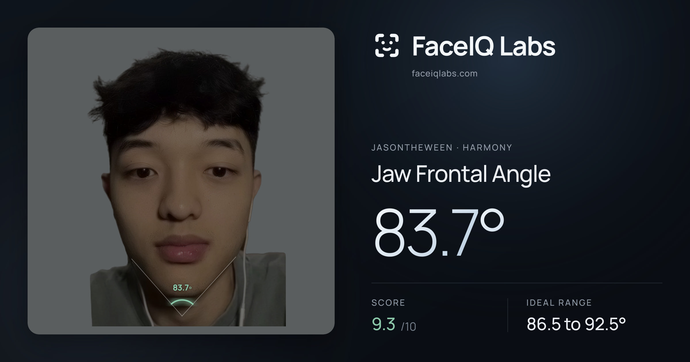 Jasontheween Jaw Frontal Angle: 83.7°, drawn on the photo