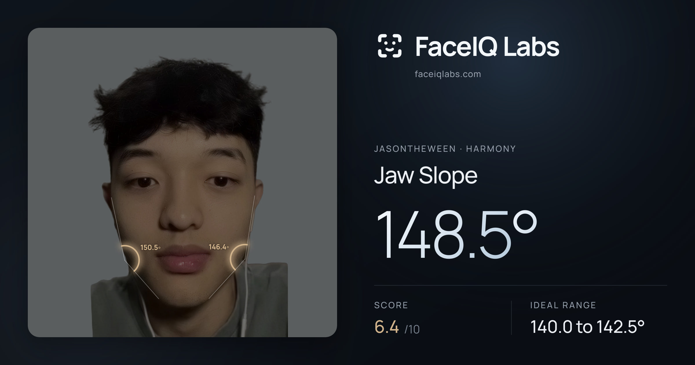 Jasontheween Jaw Slope: 148.5°, drawn on the photo