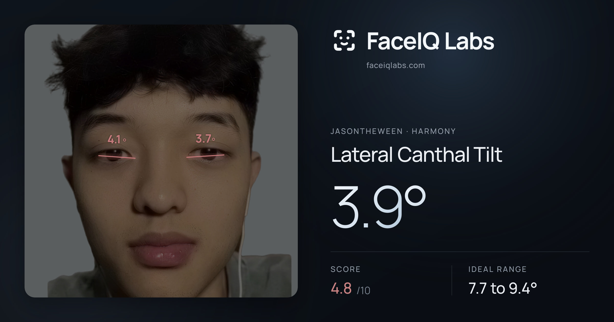 Jasontheween Lateral Canthal Tilt: 3.9°, drawn on the photo