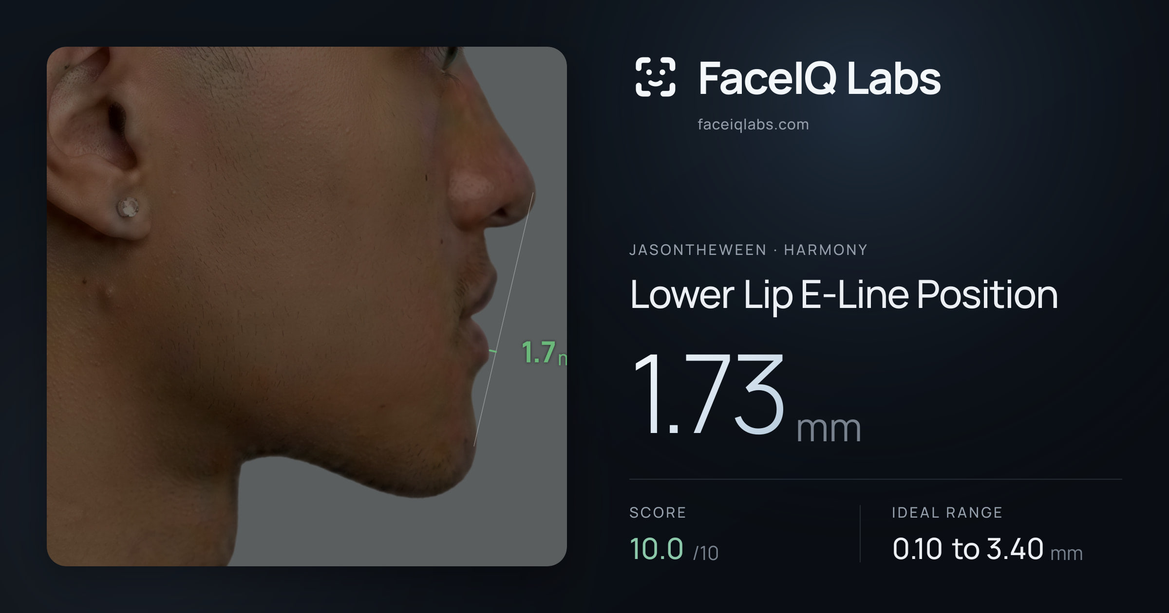 Jasontheween Lower Lip E-Line Position: 1.73mm, drawn on the photo