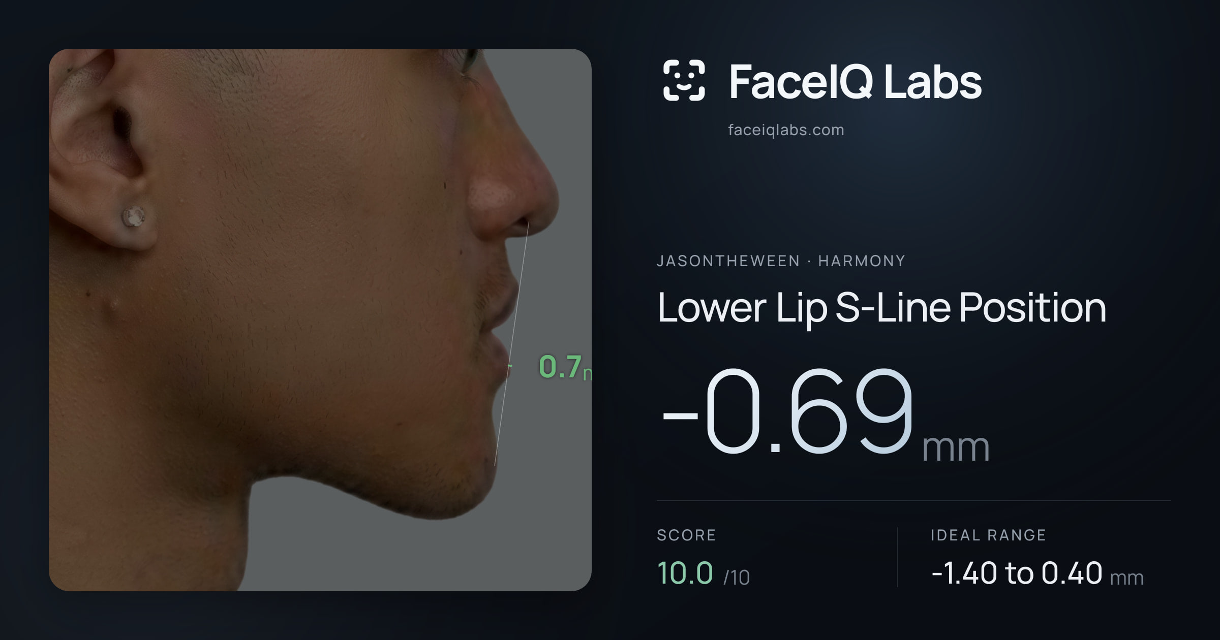 Jasontheween Lower Lip S-Line Position: -0.69mm, drawn on the photo