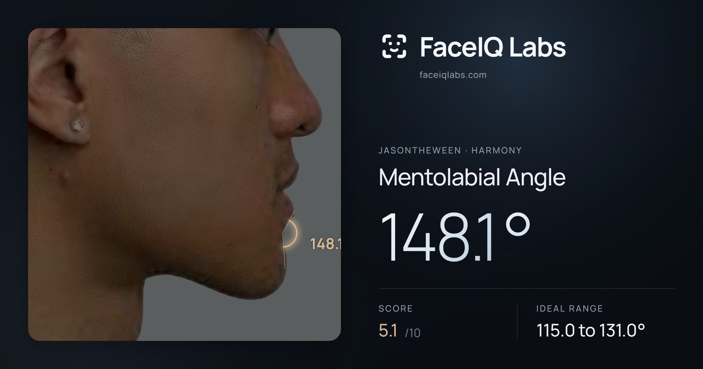 Jasontheween Mentolabial Angle: 148.1°, drawn on the photo