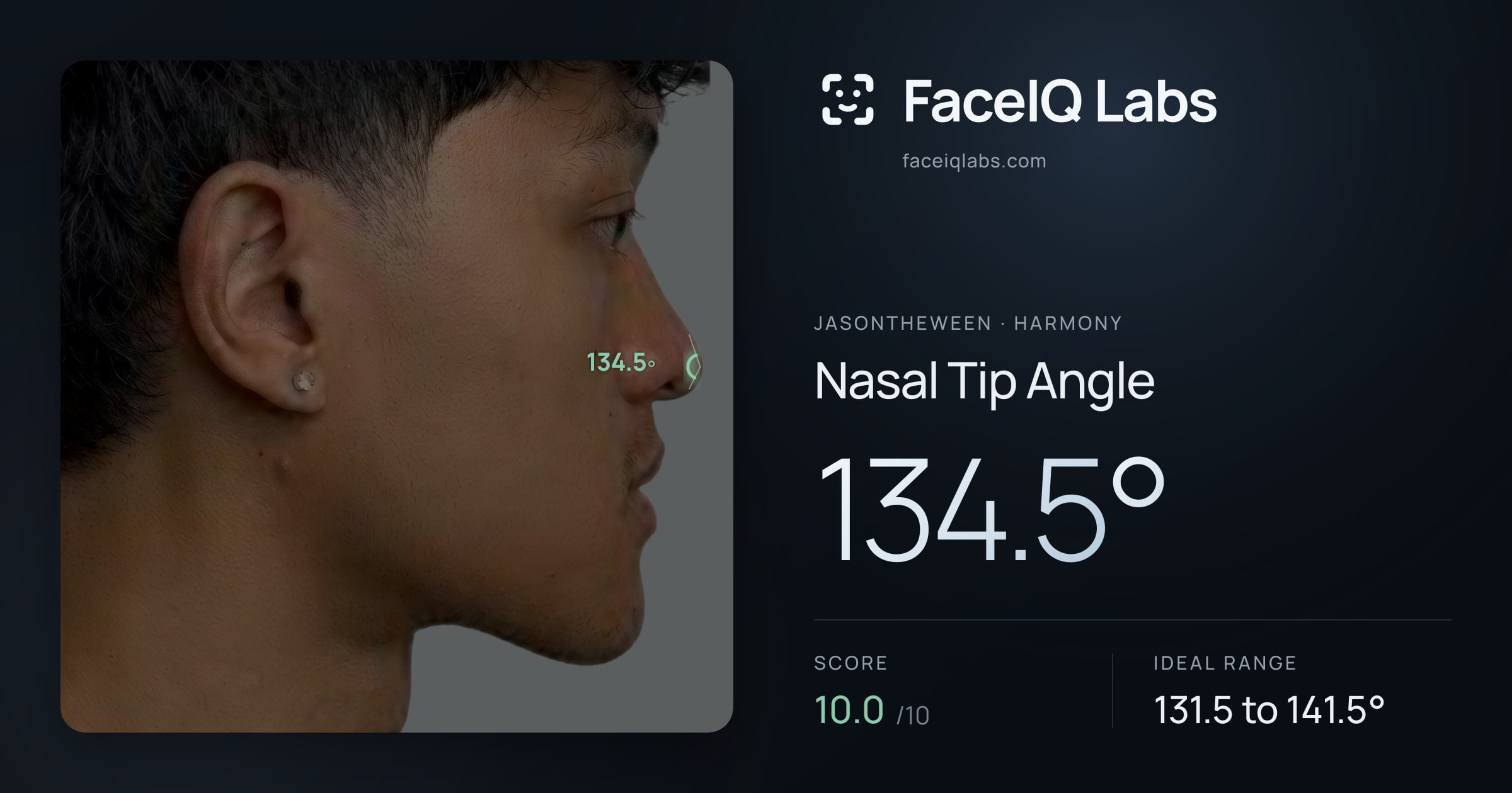 Jasontheween Nasal Tip Angle: 134.5°, drawn on the photo