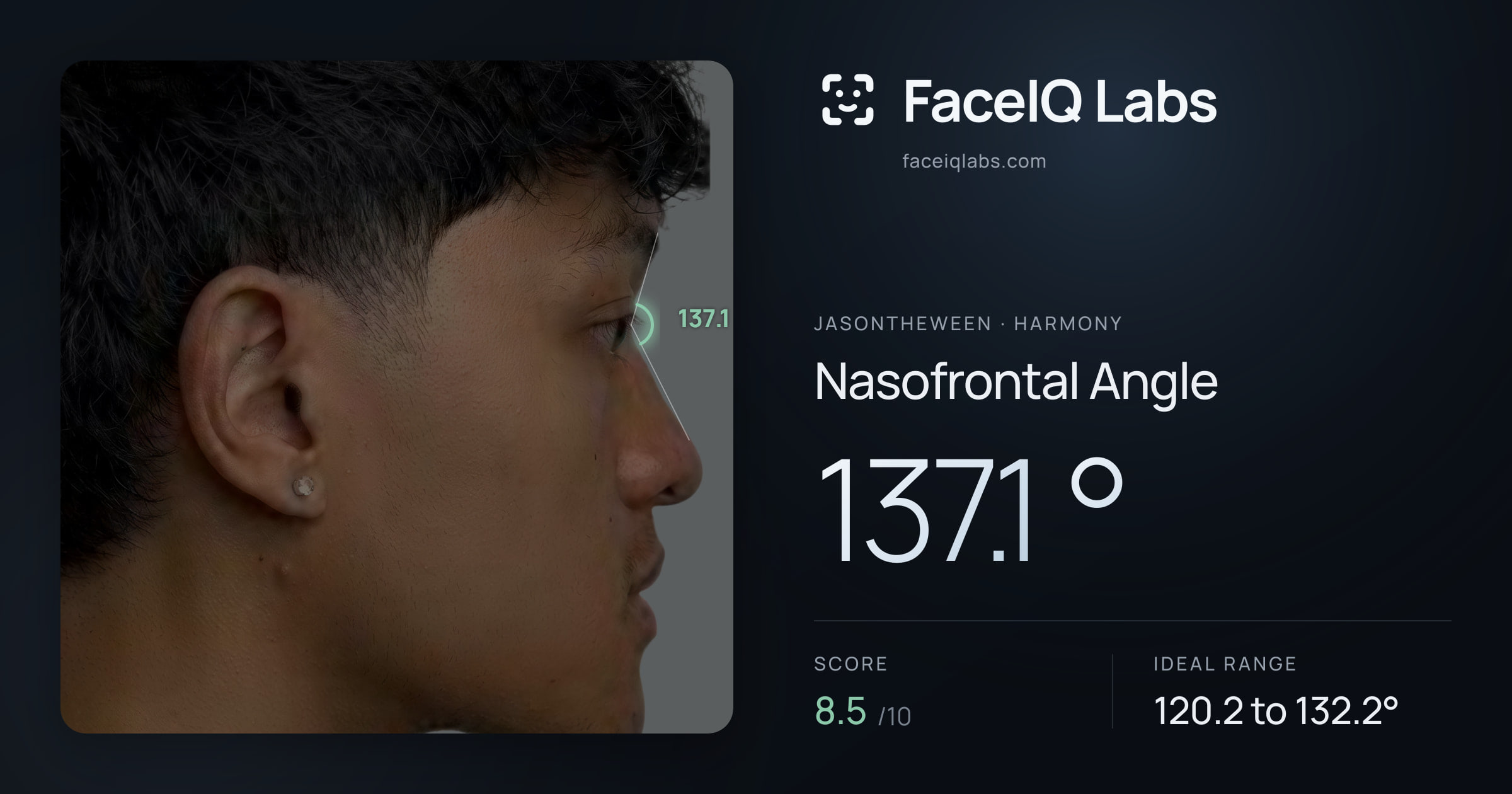Jasontheween Nasofrontal Angle: 137.1°, drawn on the photo