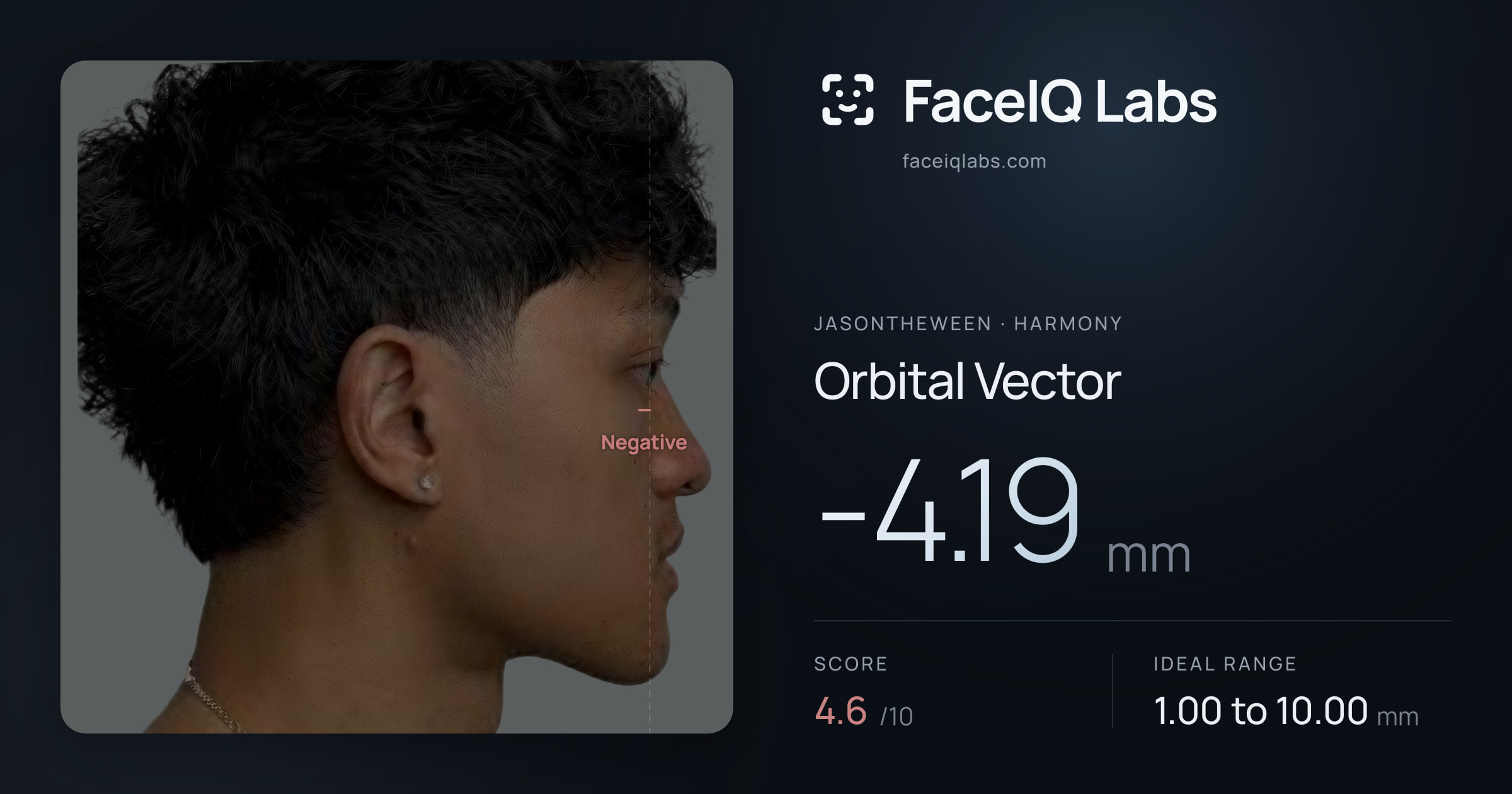 Jasontheween Orbital Vector: -4.19mm, drawn on the photo