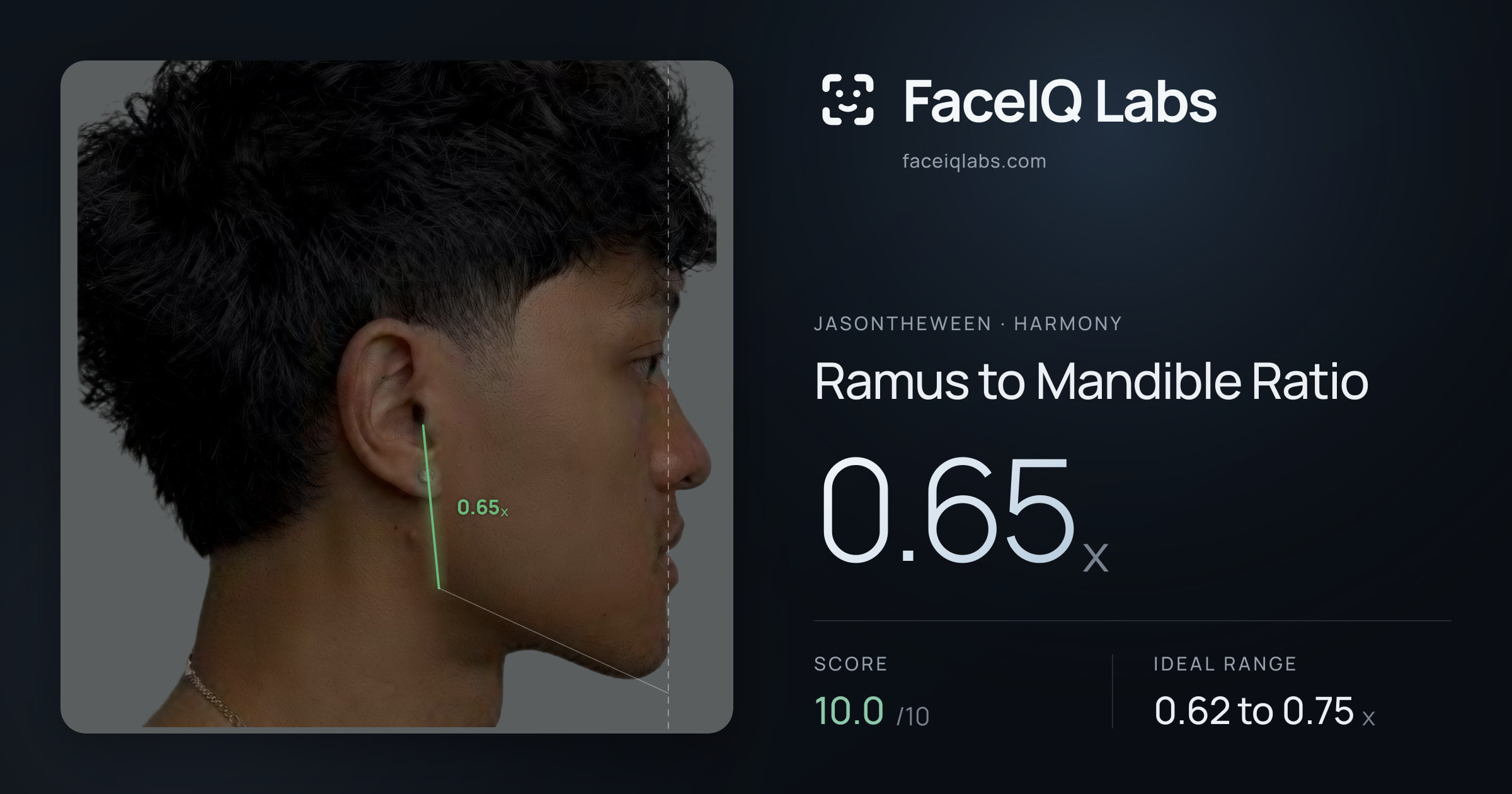 Jasontheween Ramus to Mandible Ratio: 0.65x, drawn on the photo