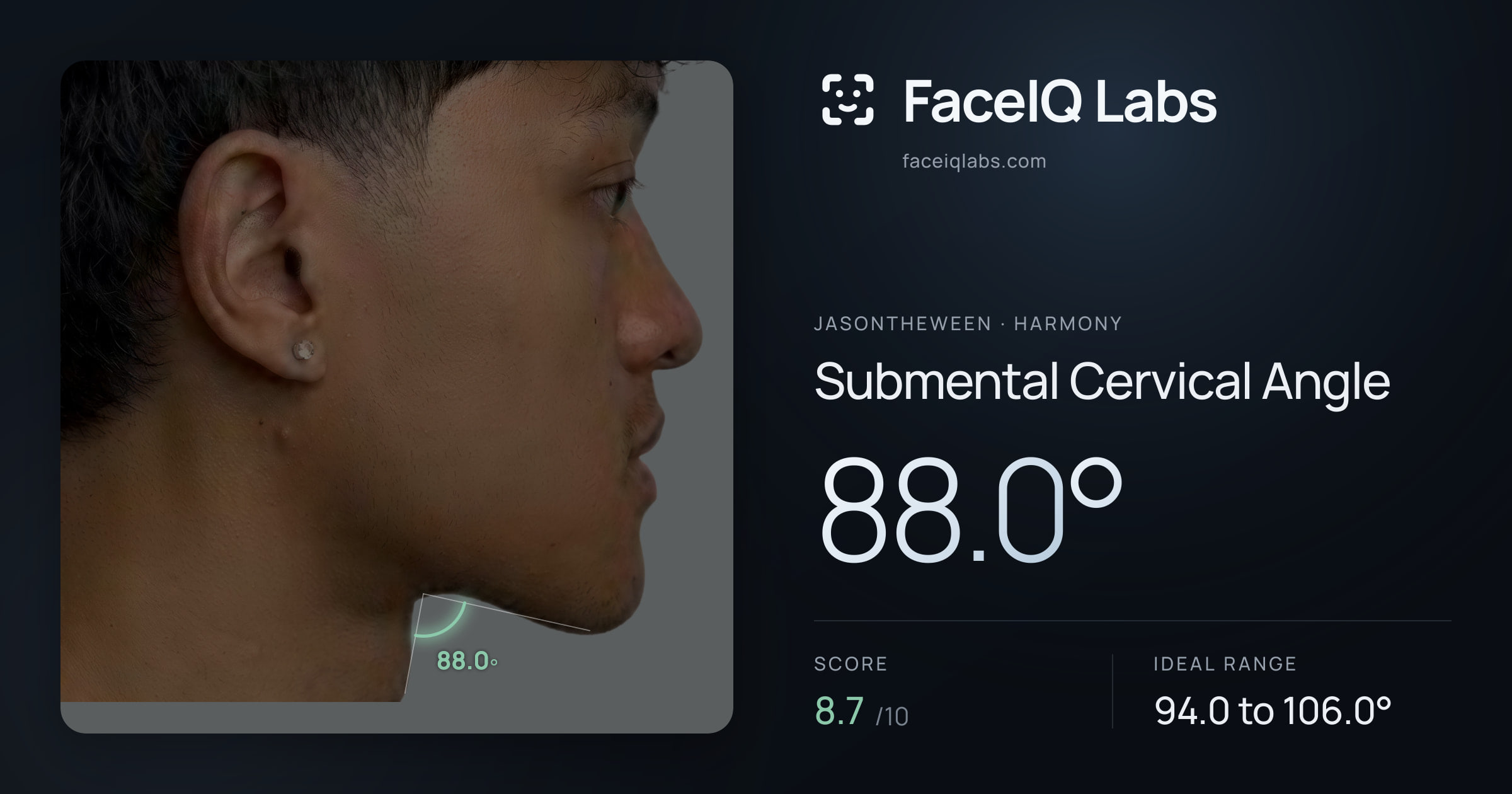 Jasontheween Submental Cervical Angle: 88.0°, drawn on the photo