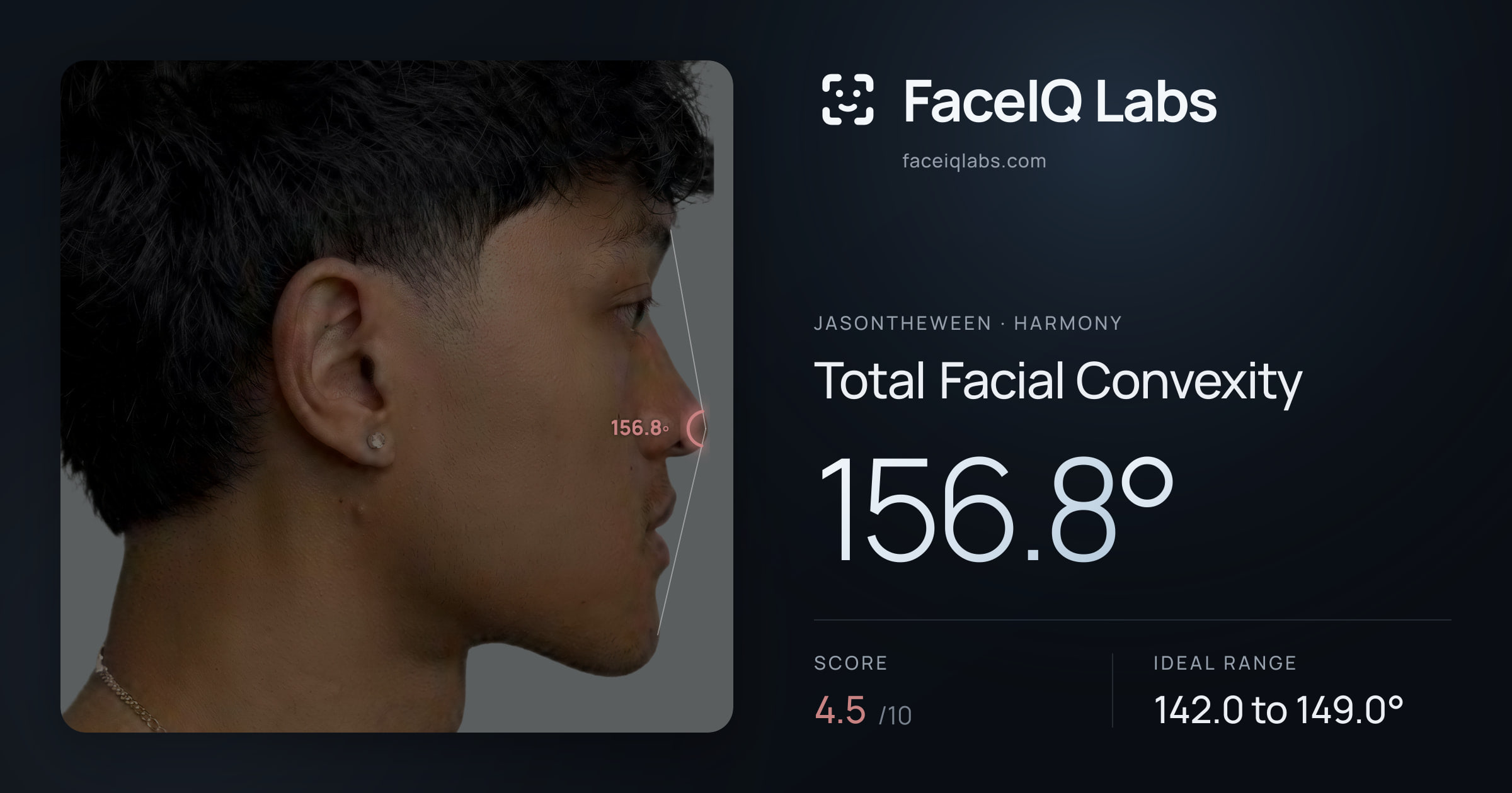 Jasontheween Total Facial Convexity: 156.8°, drawn on the photo