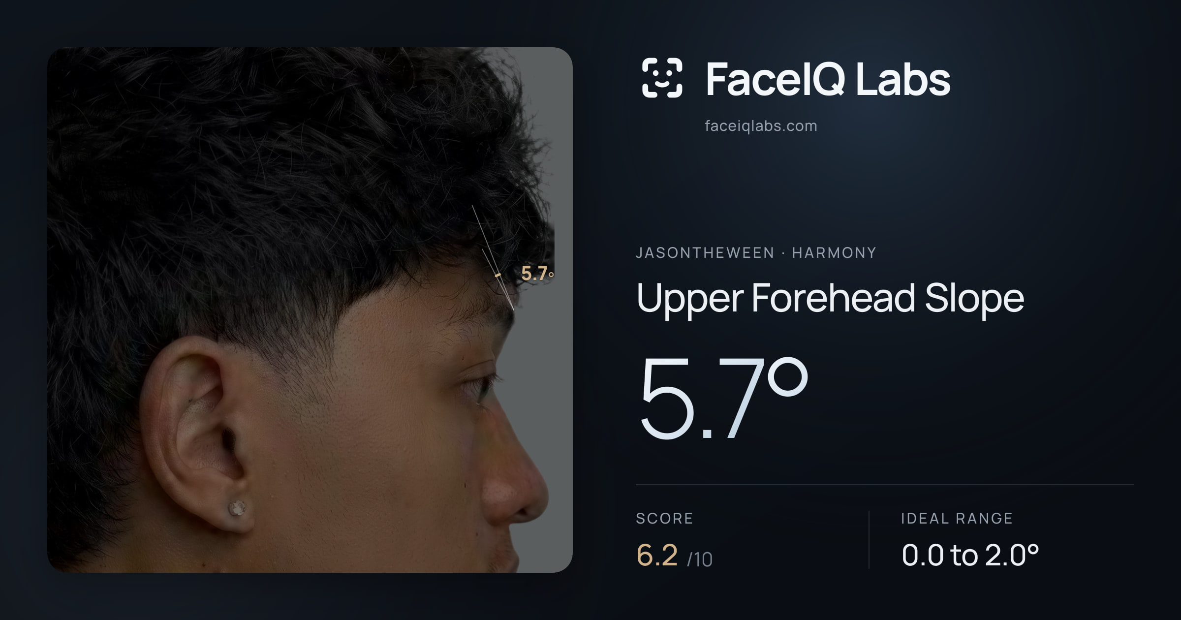Jasontheween Upper Forehead Slope: 5.7°, drawn on the photo