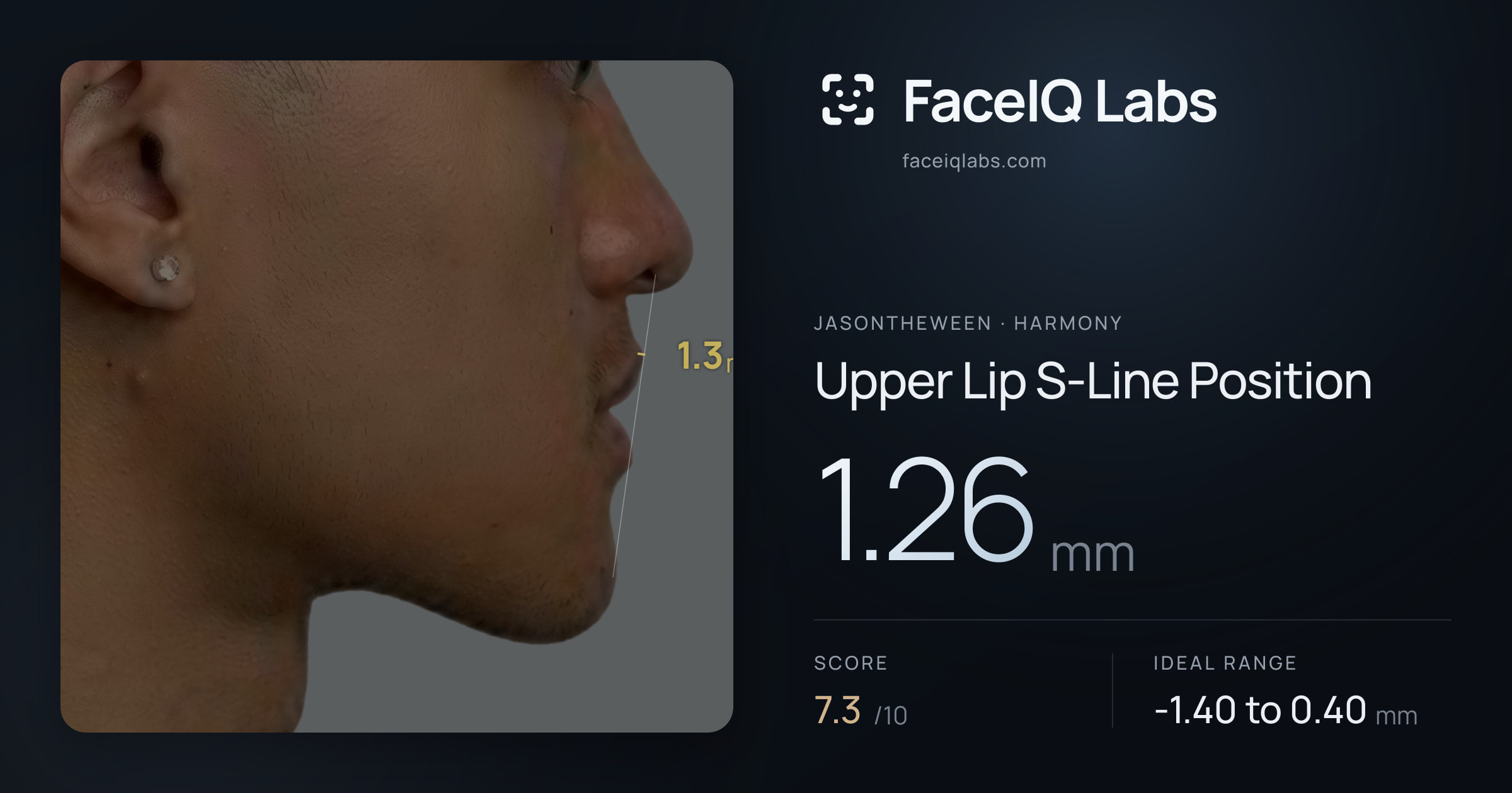 Jasontheween Upper Lip S-Line Position: 1.26mm, drawn on the photo