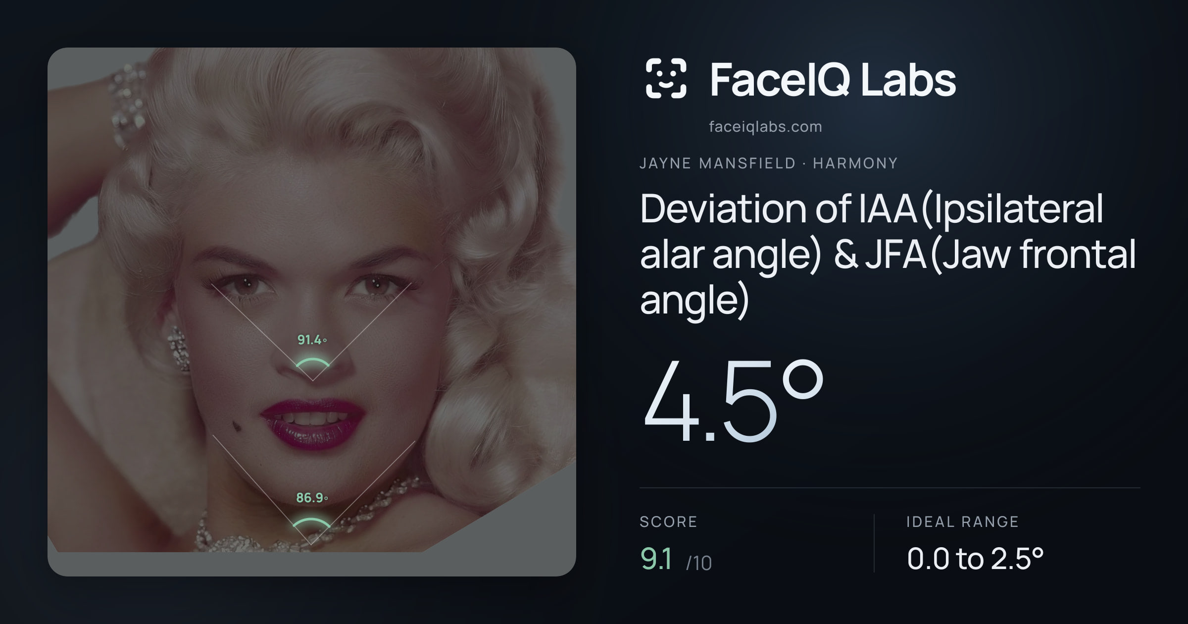 Jayne Mansfield Deviation of IAA(Ipsilateral alar angle) & JFA(Jaw frontal angle): 4.5°, drawn on the photo