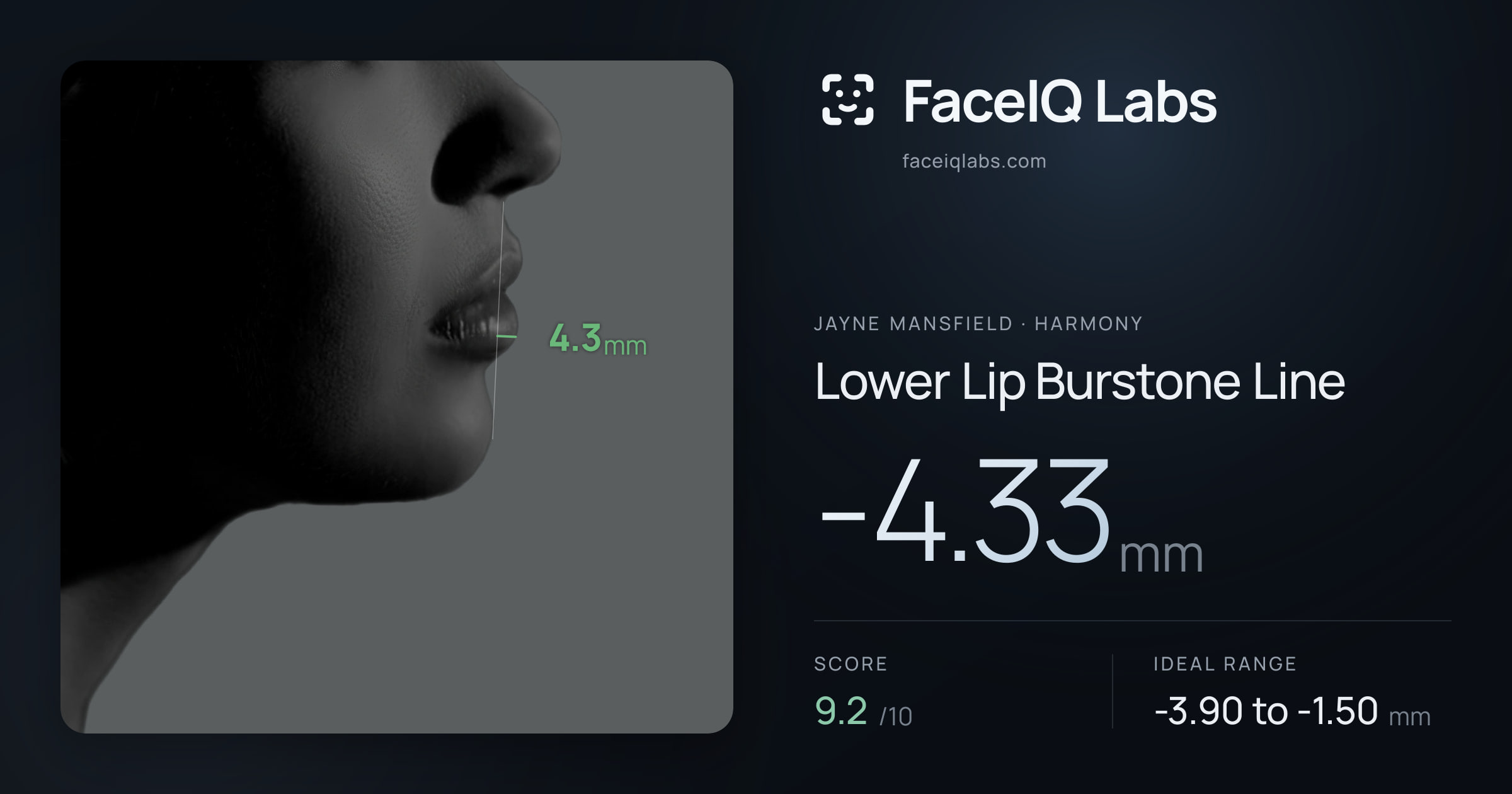 Jayne Mansfield Lower Lip Burstone Line: -4.33mm, drawn on the photo