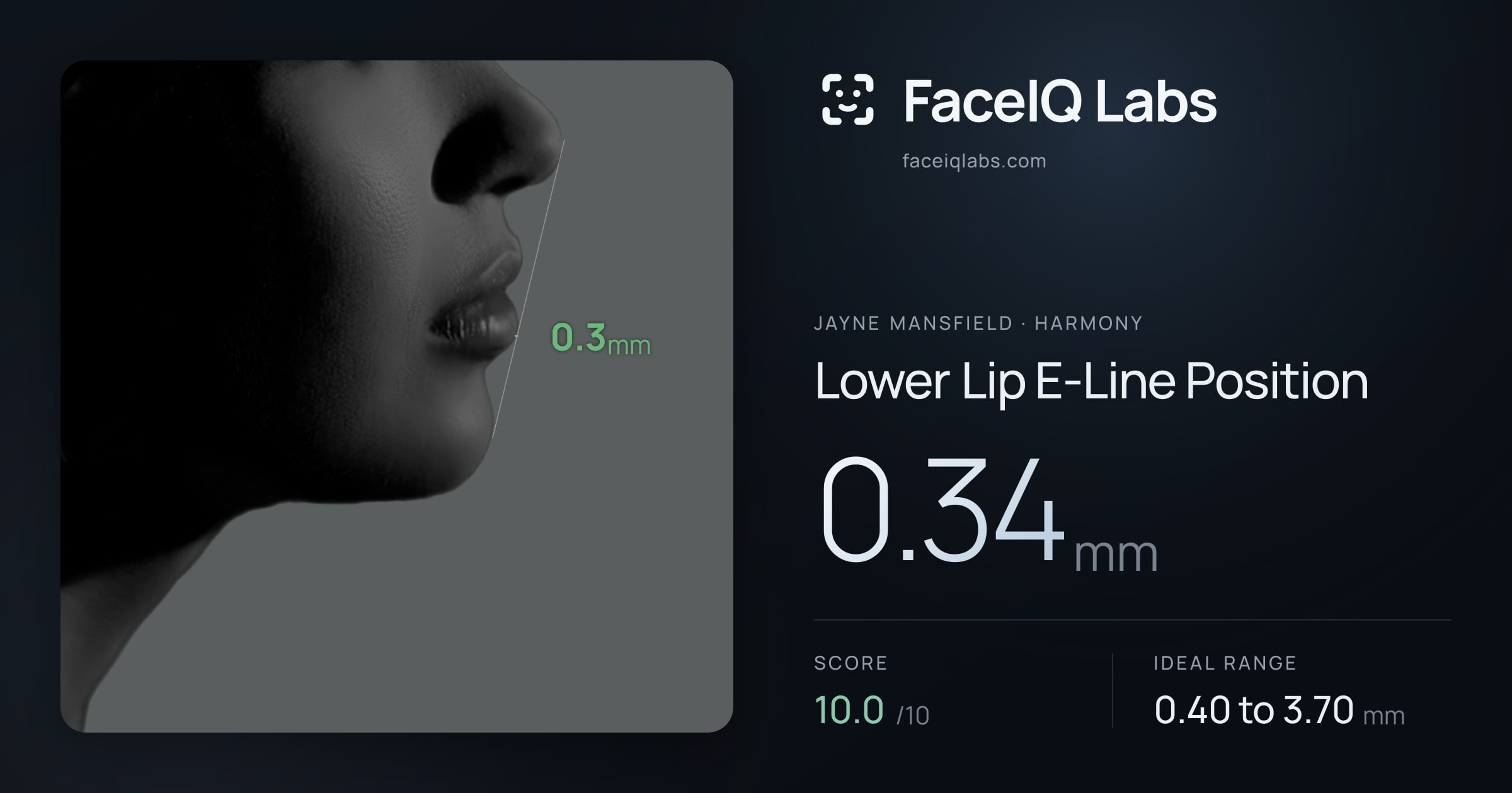 Jayne Mansfield Lower Lip E-Line Position: 0.34mm, drawn on the photo