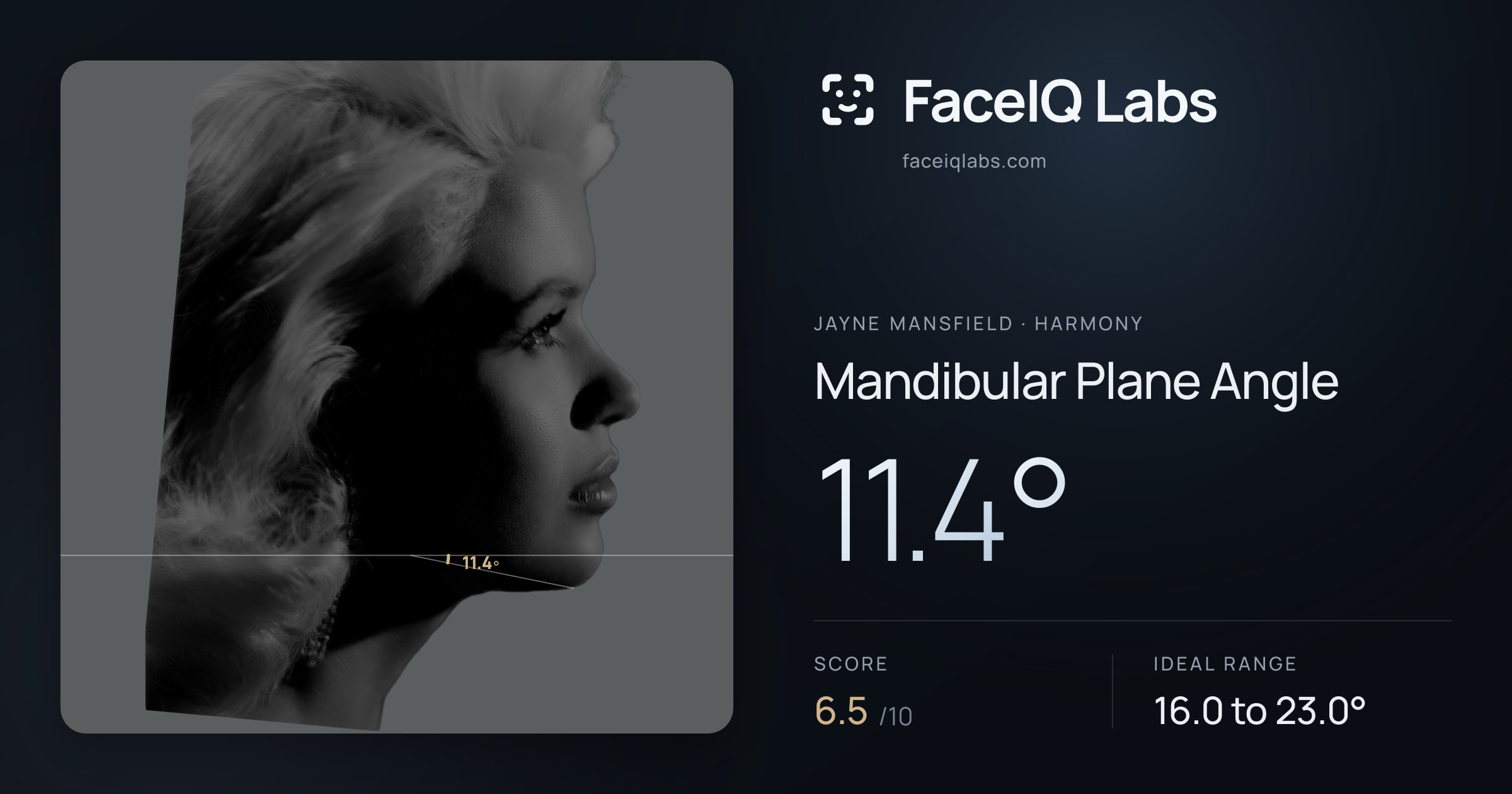 Jayne Mansfield Mandibular Plane Angle: 11.4°, drawn on the photo