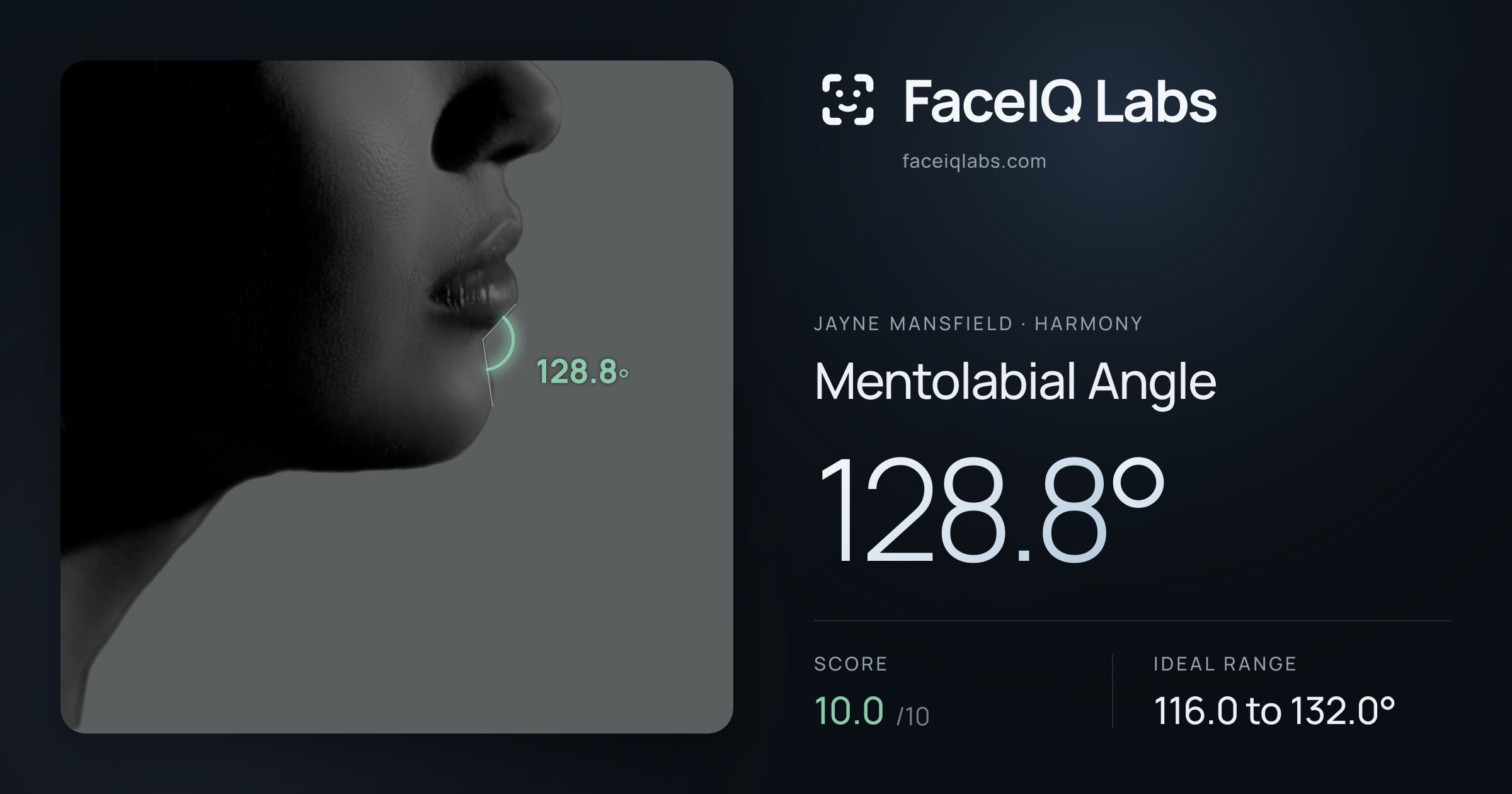 Jayne Mansfield Mentolabial Angle: 128.8°, drawn on the photo