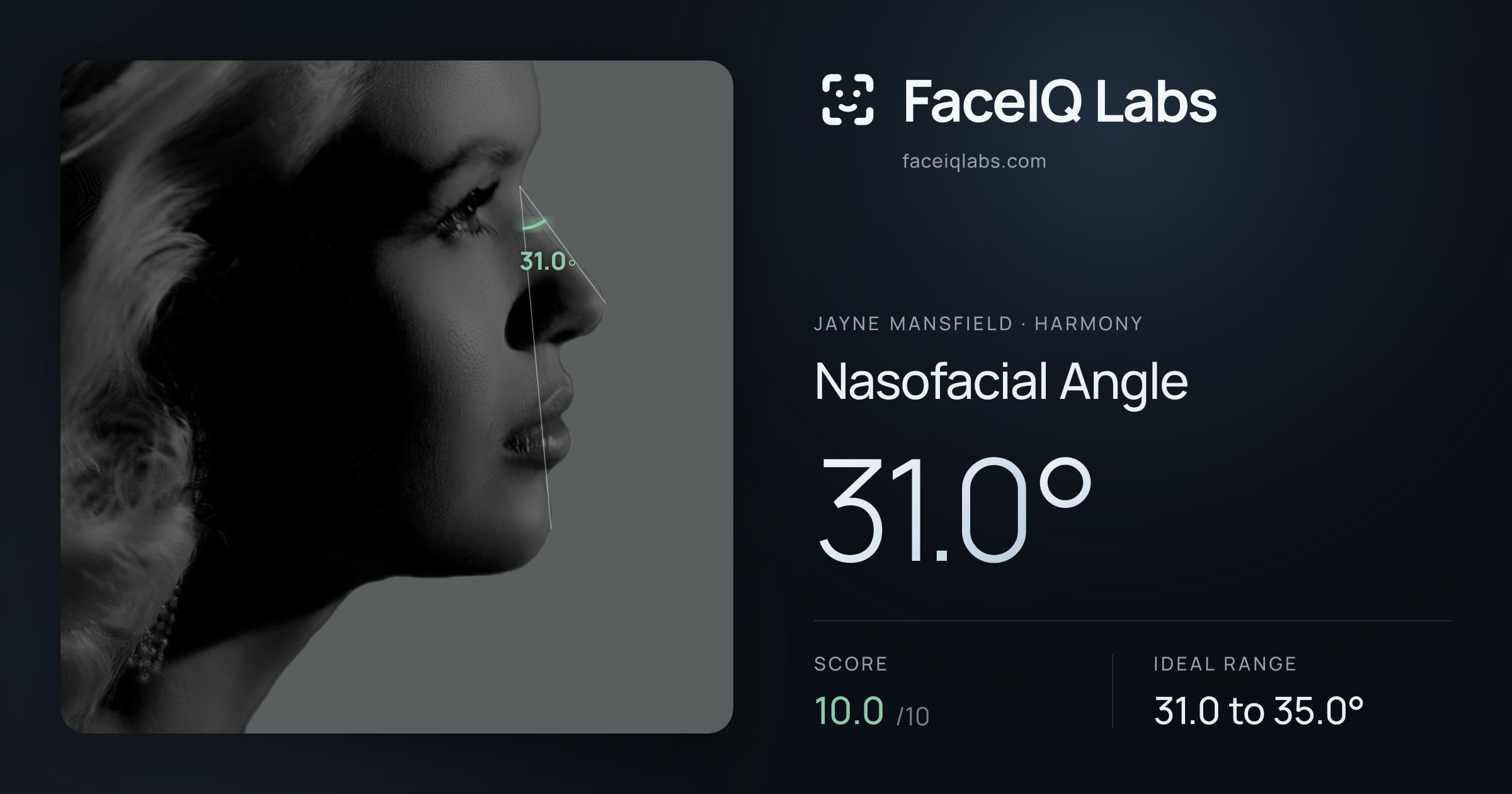 Jayne Mansfield Nasofacial Angle: 31.0°, drawn on the photo