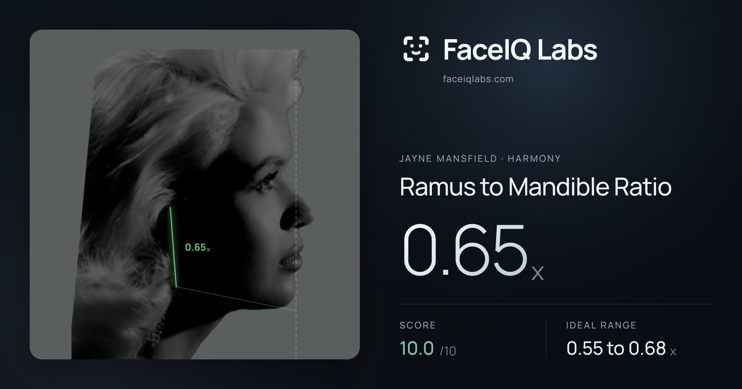 Jayne Mansfield Ramus to Mandible Ratio: 0.65x, drawn on the photo