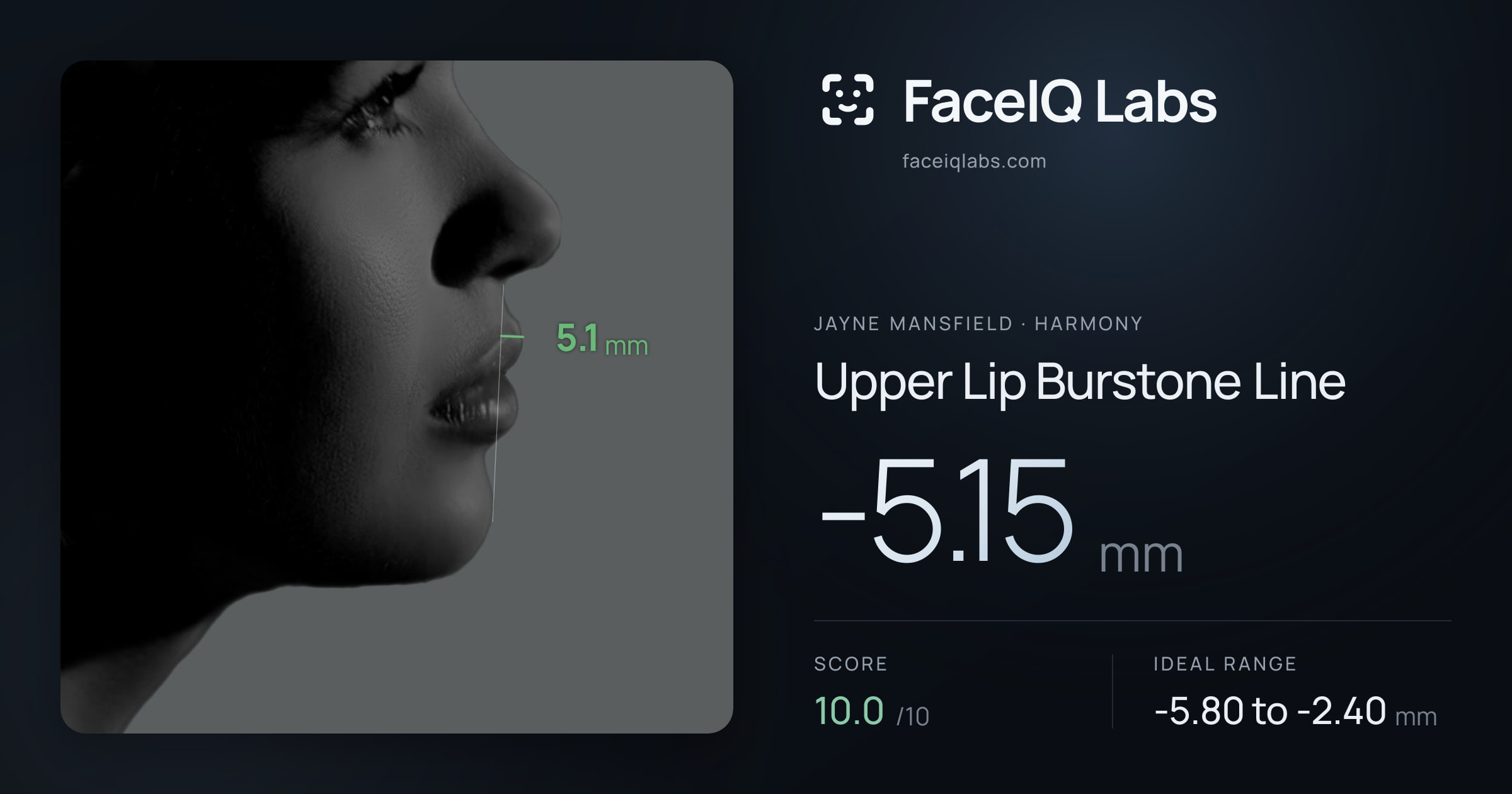 Jayne Mansfield Upper Lip Burstone Line: -5.15mm, drawn on the photo