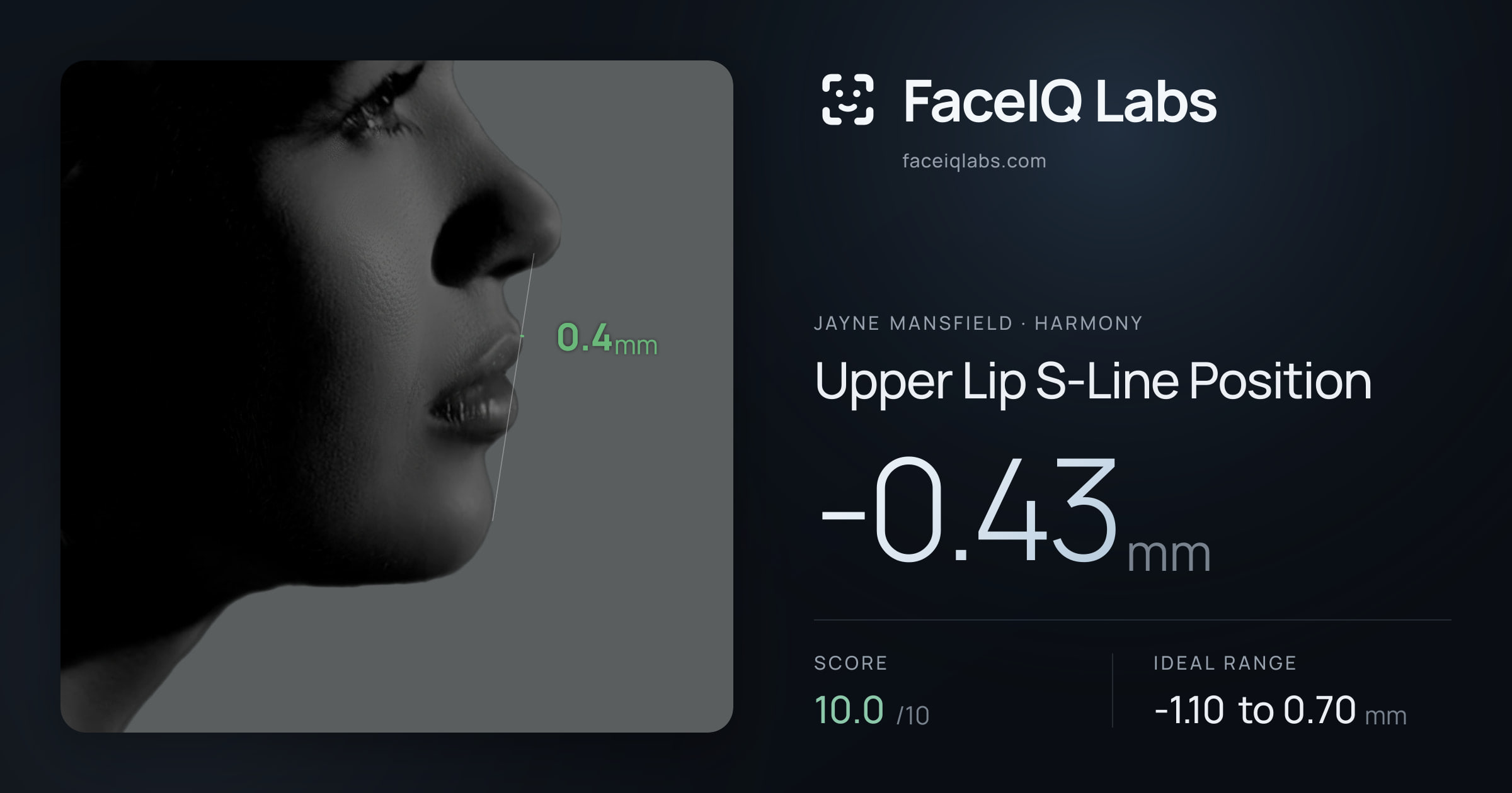 Jayne Mansfield Upper Lip S-Line Position: -0.43mm, drawn on the photo