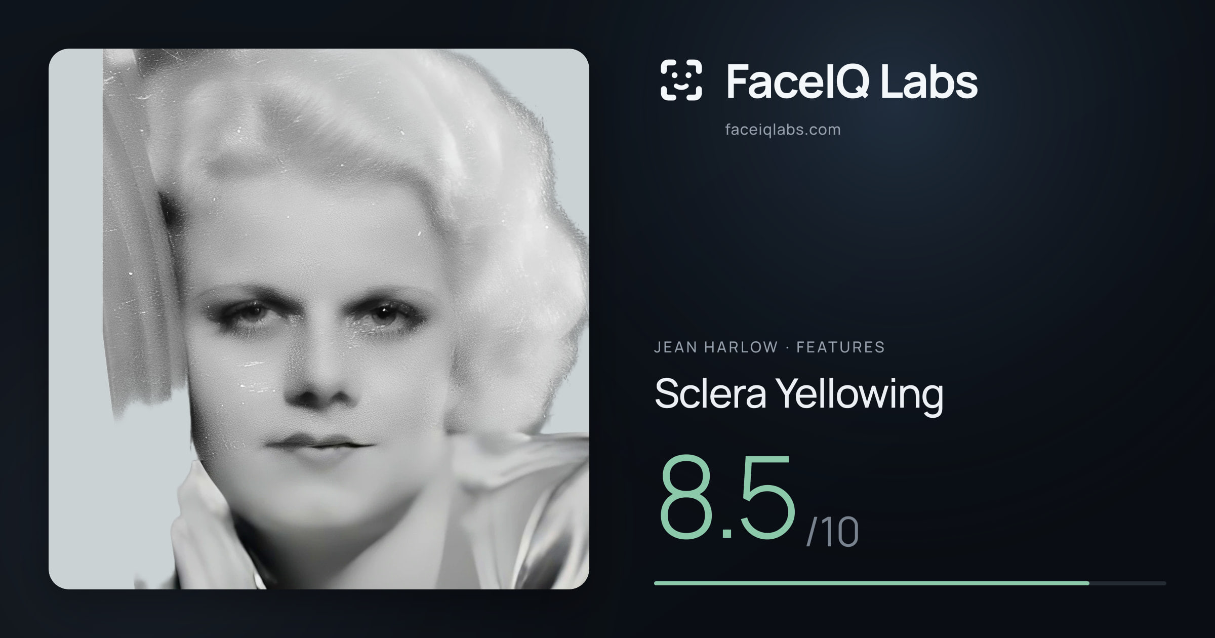 Jean Harlow Sclera Yellowing: 8.5/10, drawn on the photo