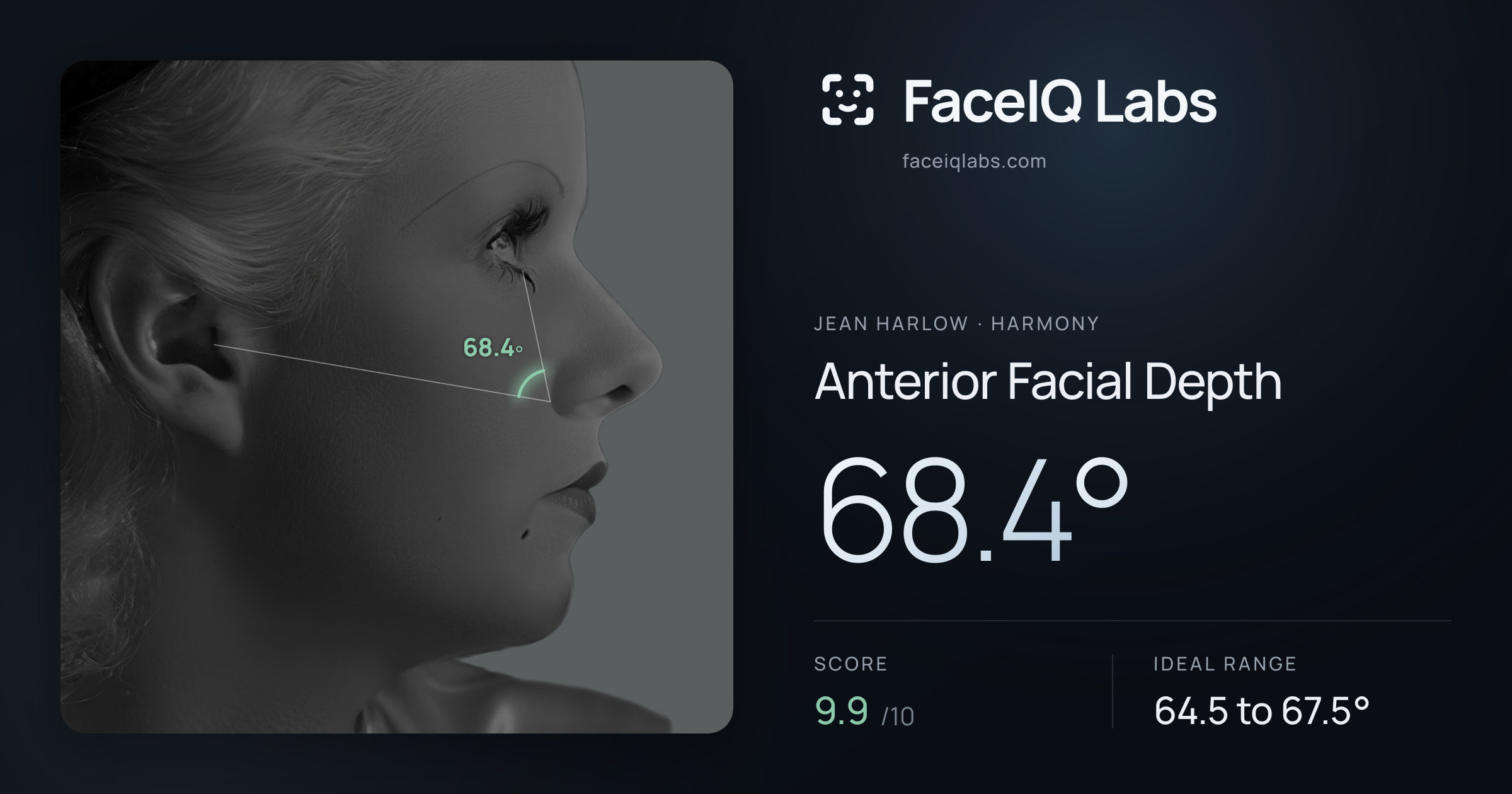 Jean Harlow Anterior Facial Depth: 68.4°, drawn on the photo