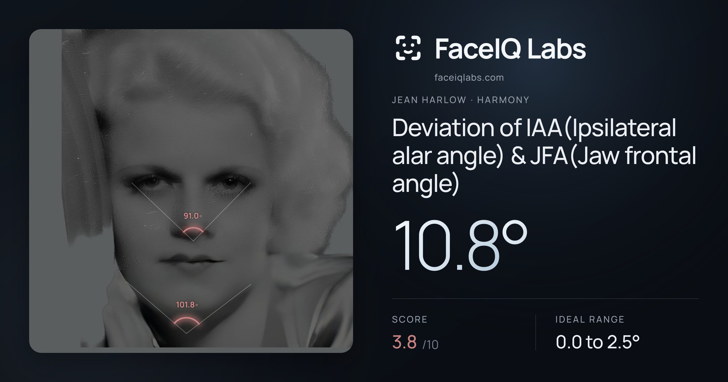 Jean Harlow Deviation of IAA(Ipsilateral alar angle) & JFA(Jaw frontal angle): 10.8°, drawn on the photo