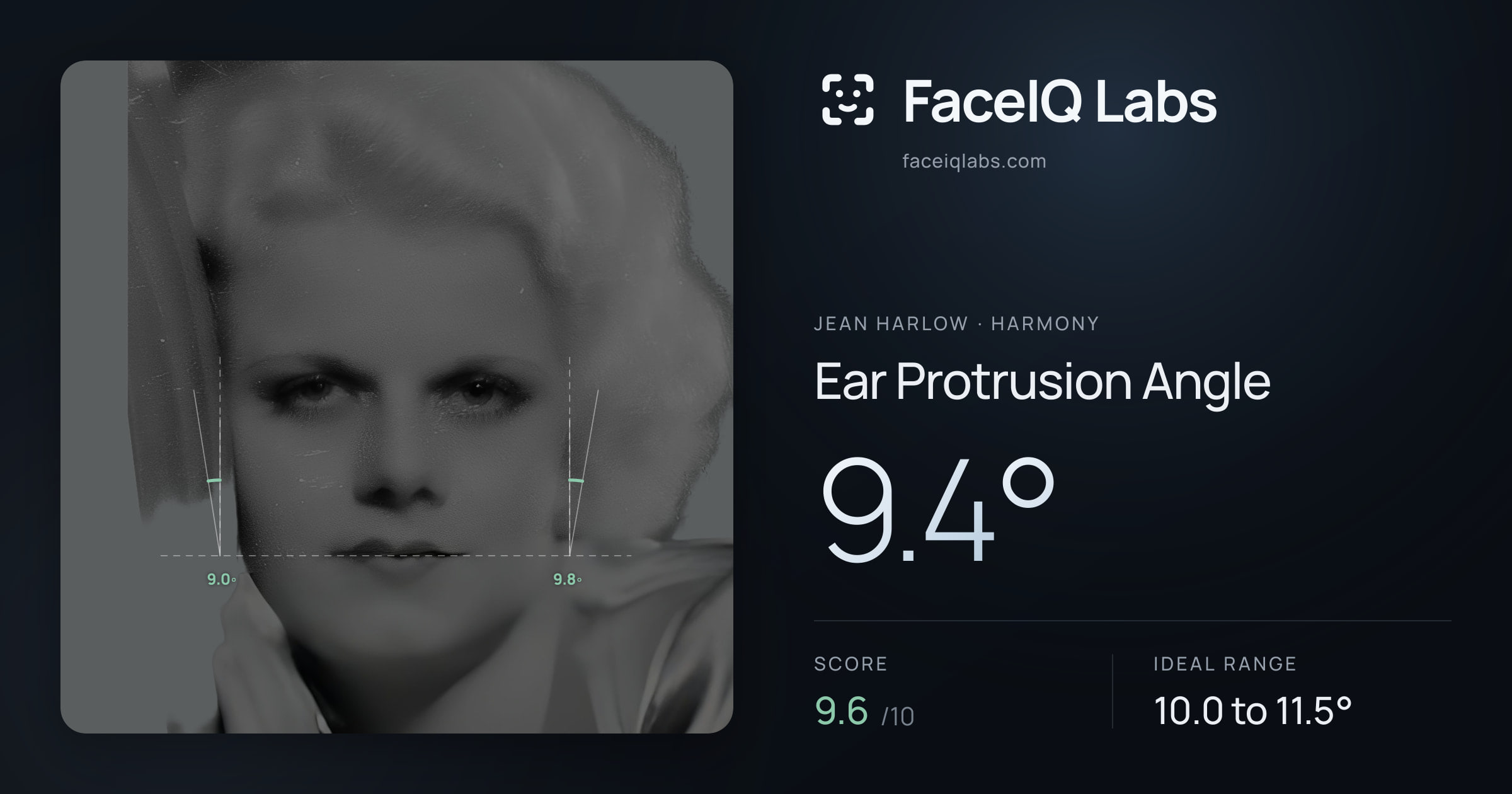 Jean Harlow Ear Protrusion Angle: 9.4°, drawn on the photo