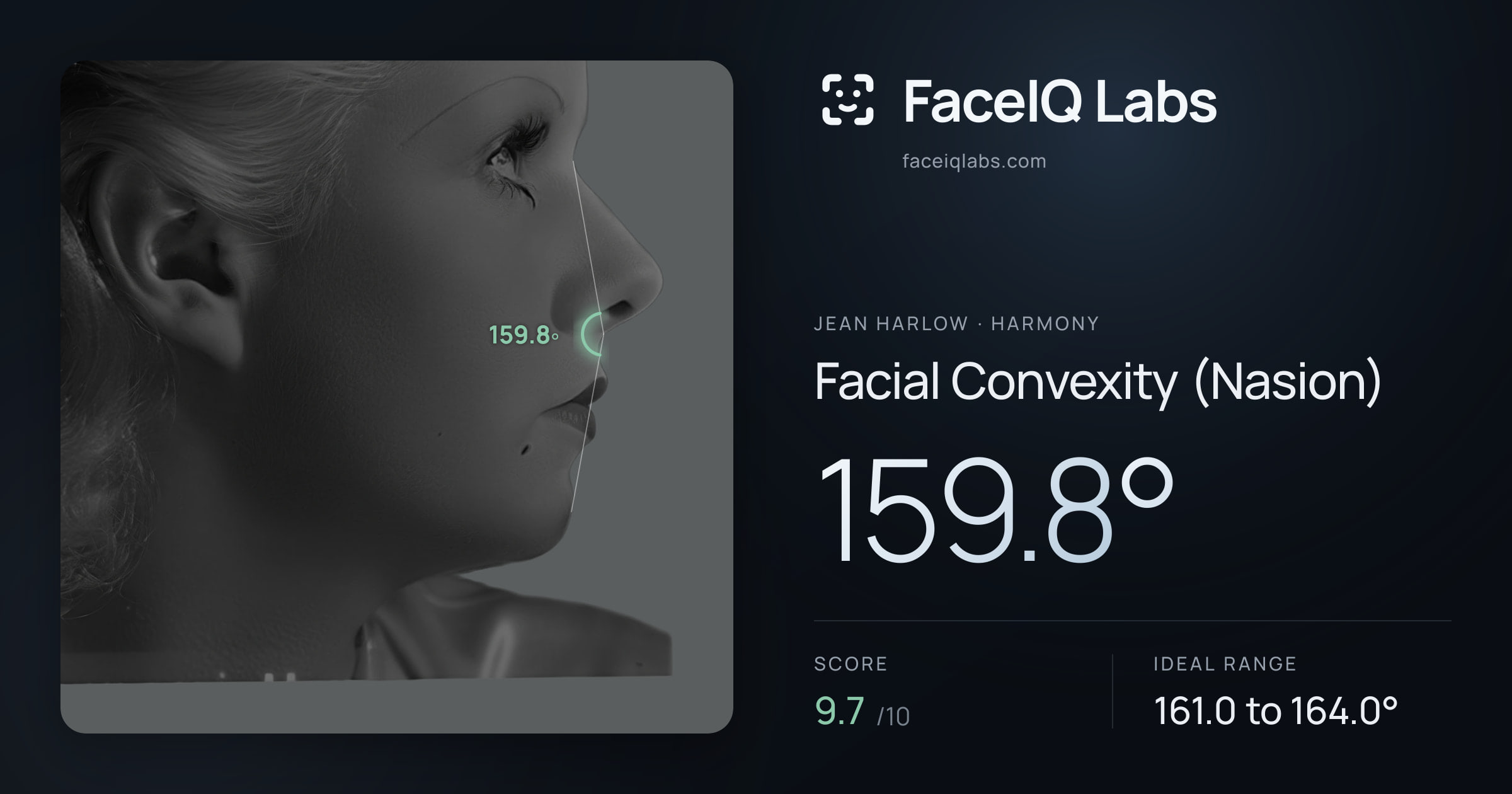 Jean Harlow Facial Convexity (Nasion): 159.8°, drawn on the photo