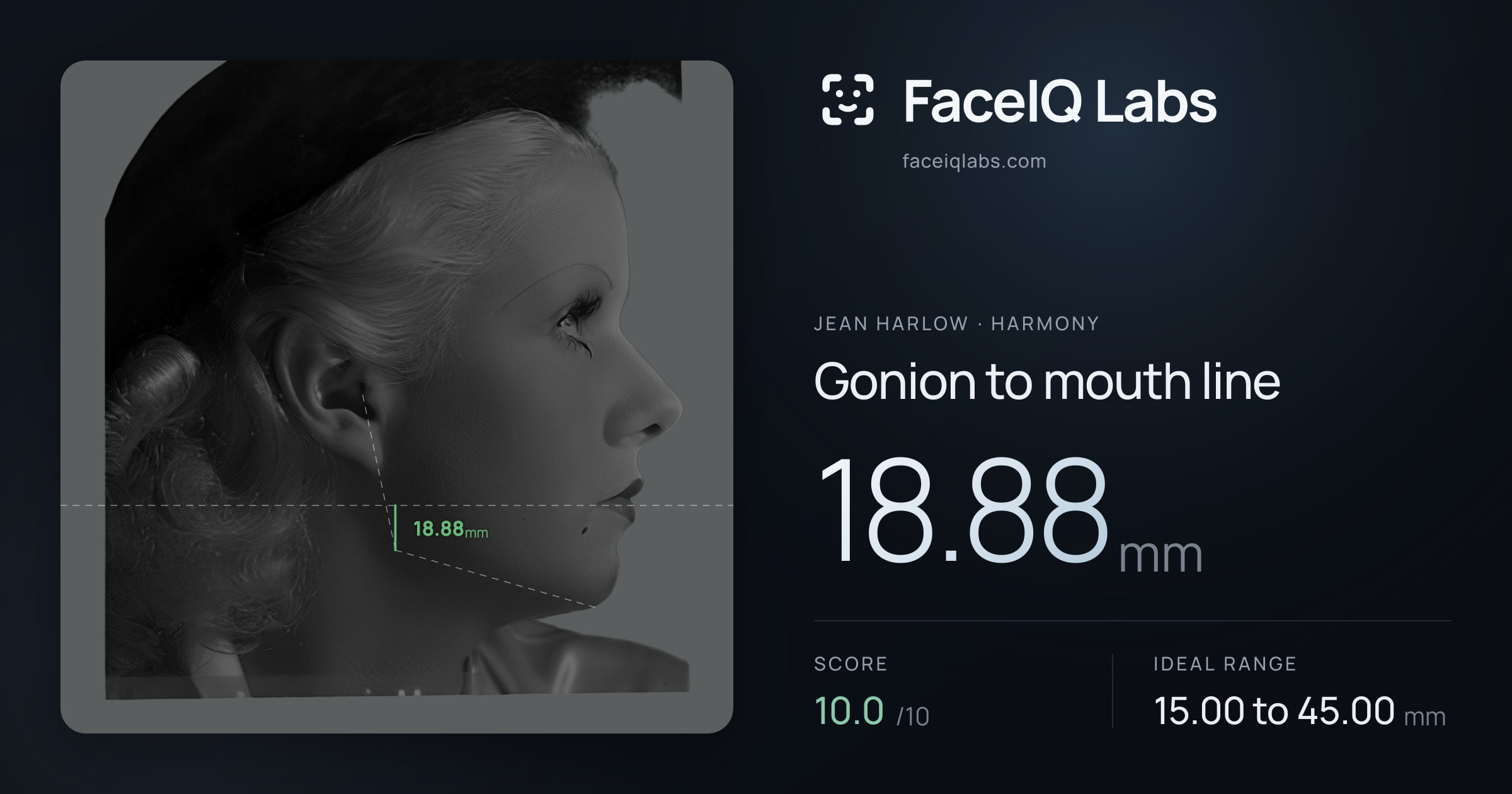 Jean Harlow Gonion to mouth line: 18.88mm, drawn on the photo