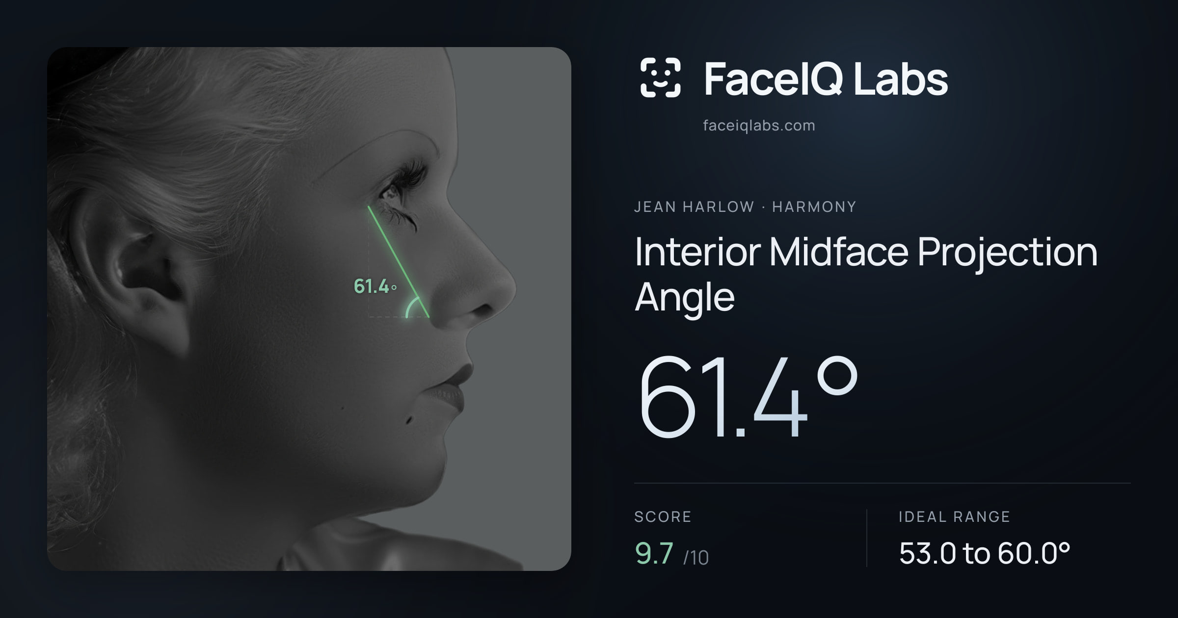 Jean Harlow Interior Midface Projection Angle: 61.4°, drawn on the photo