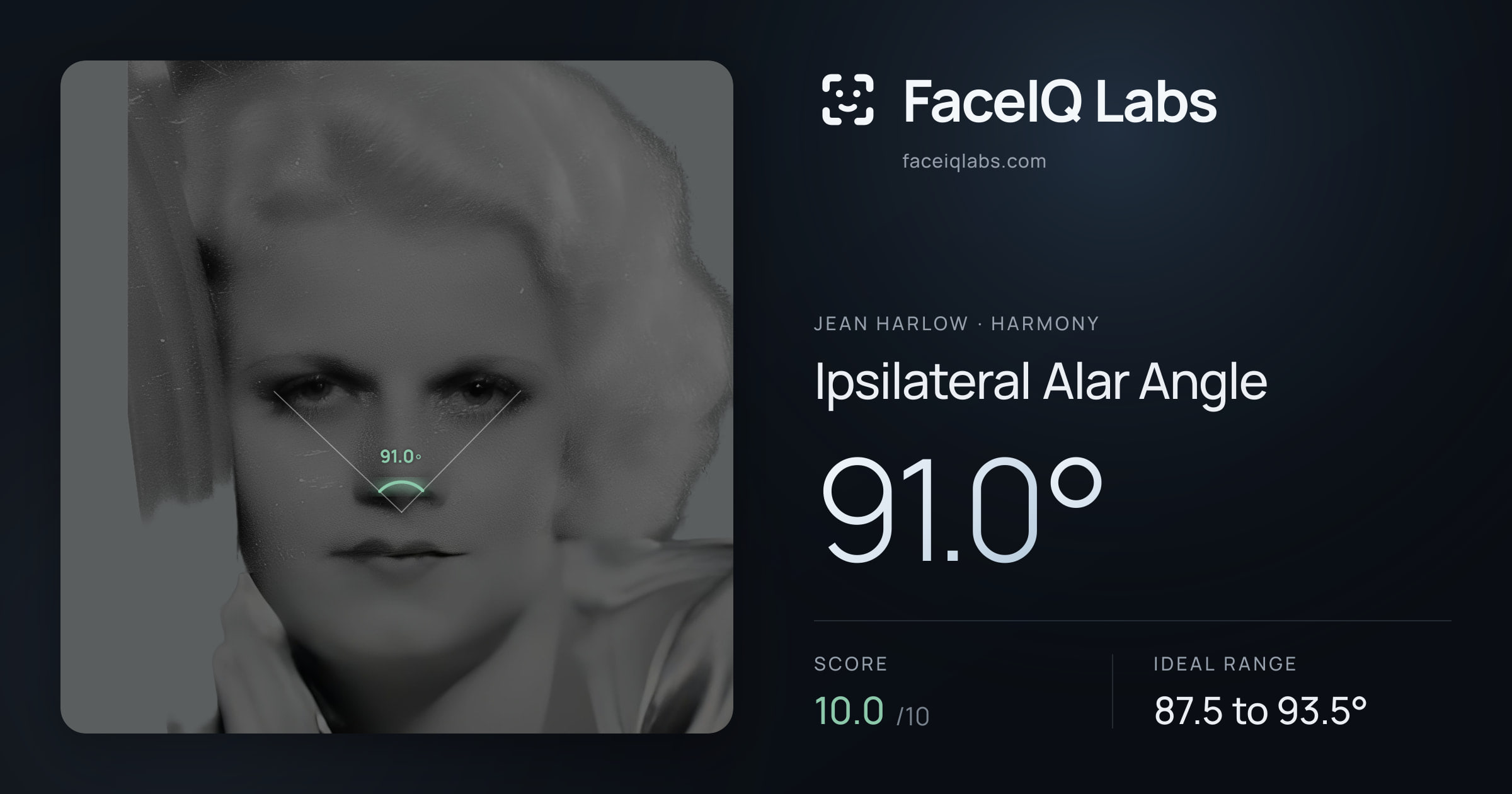 Jean Harlow Ipsilateral Alar Angle: 91.0°, drawn on the photo