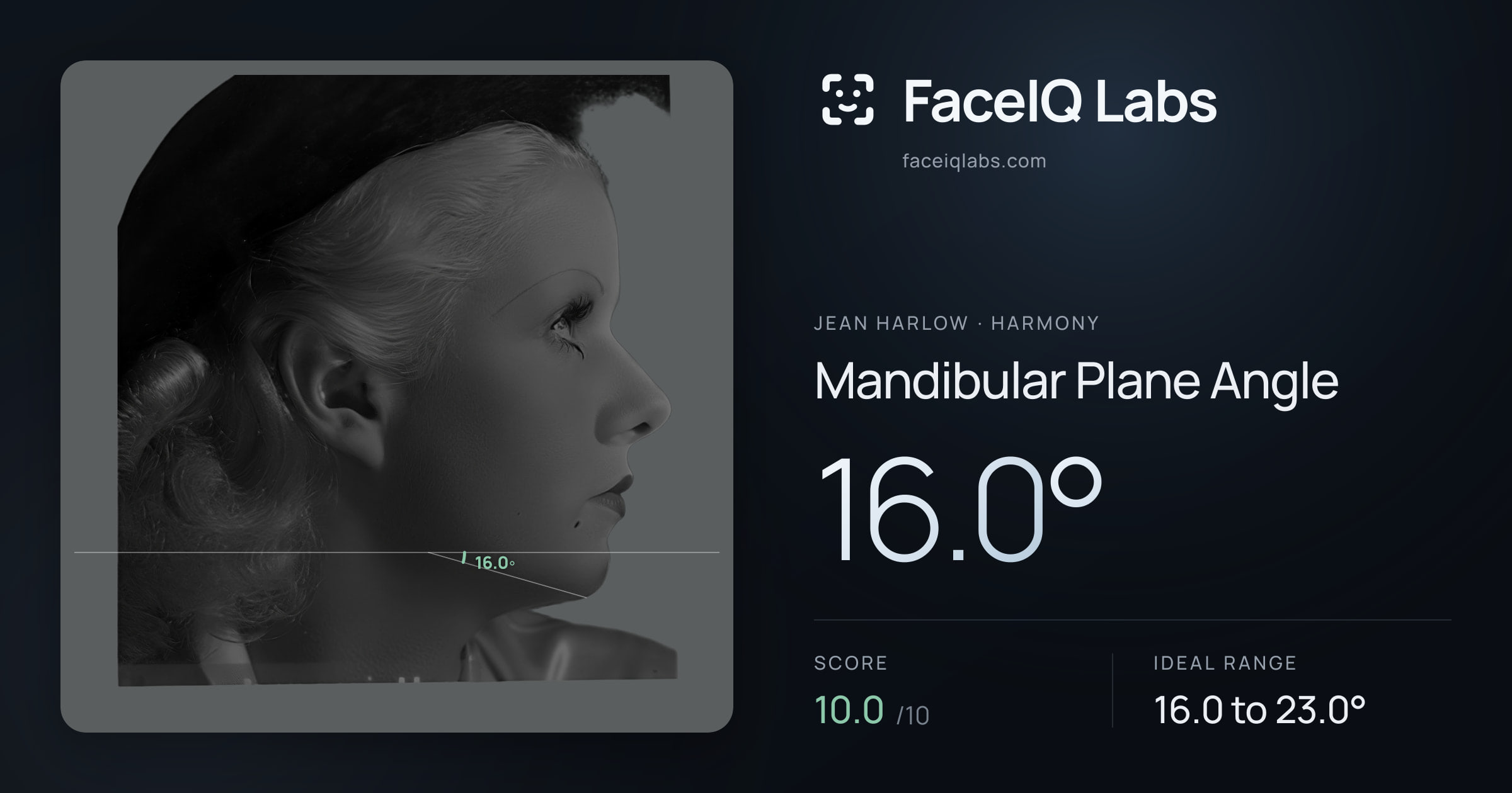 Jean Harlow Mandibular Plane Angle: 16.0°, drawn on the photo