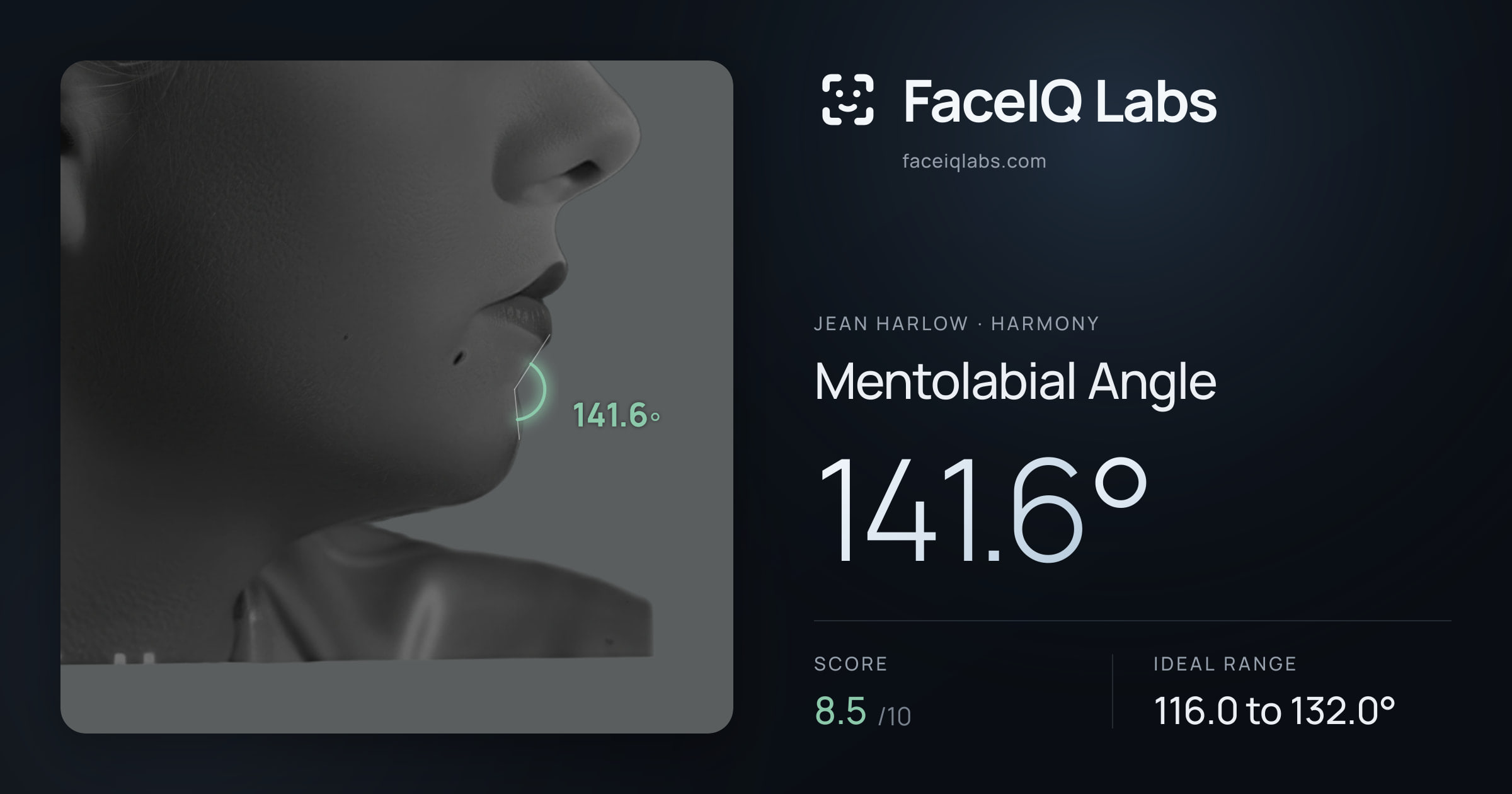 Jean Harlow Mentolabial Angle: 141.6°, drawn on the photo