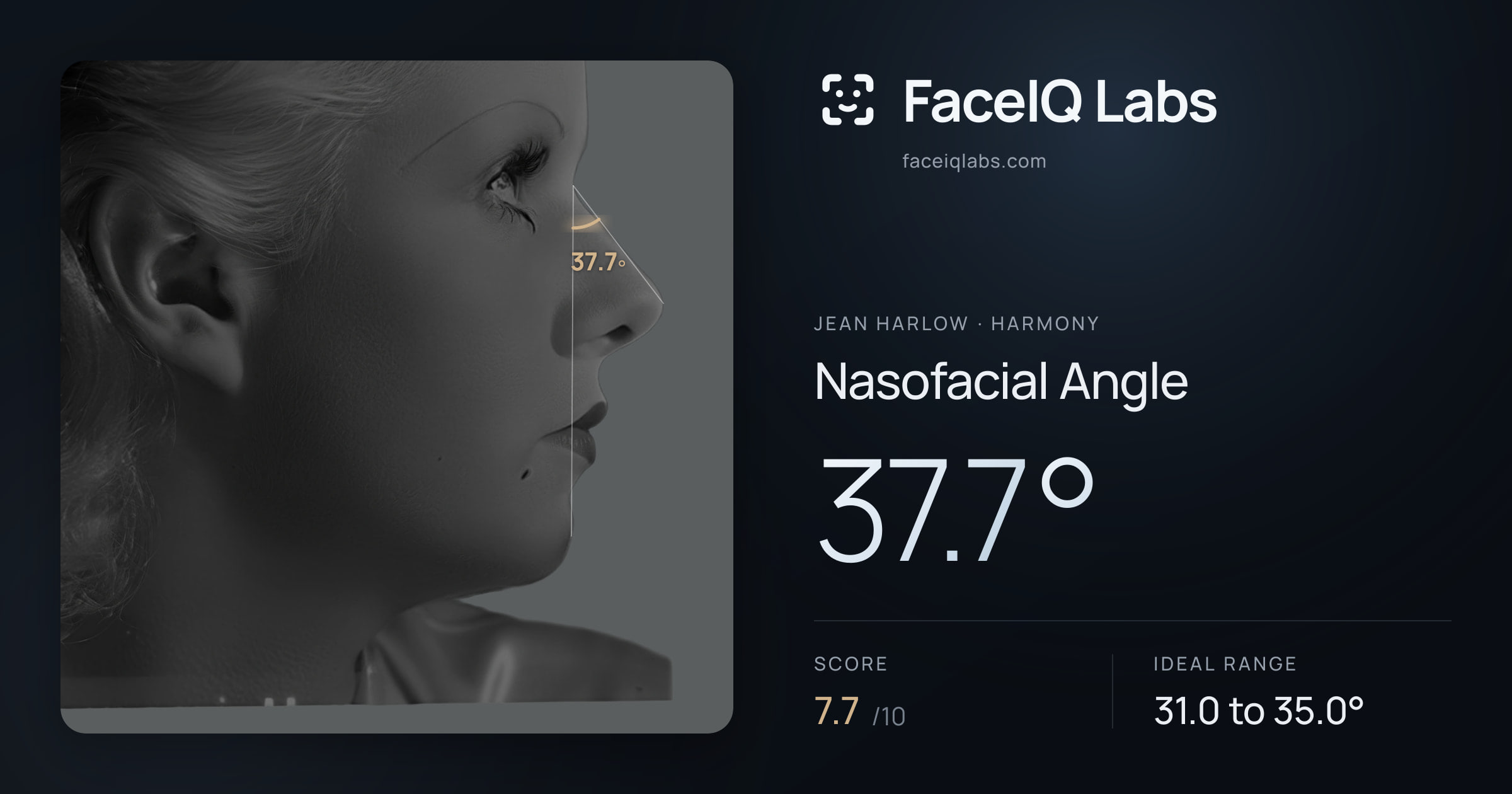 Jean Harlow Nasofacial Angle: 37.7°, drawn on the photo