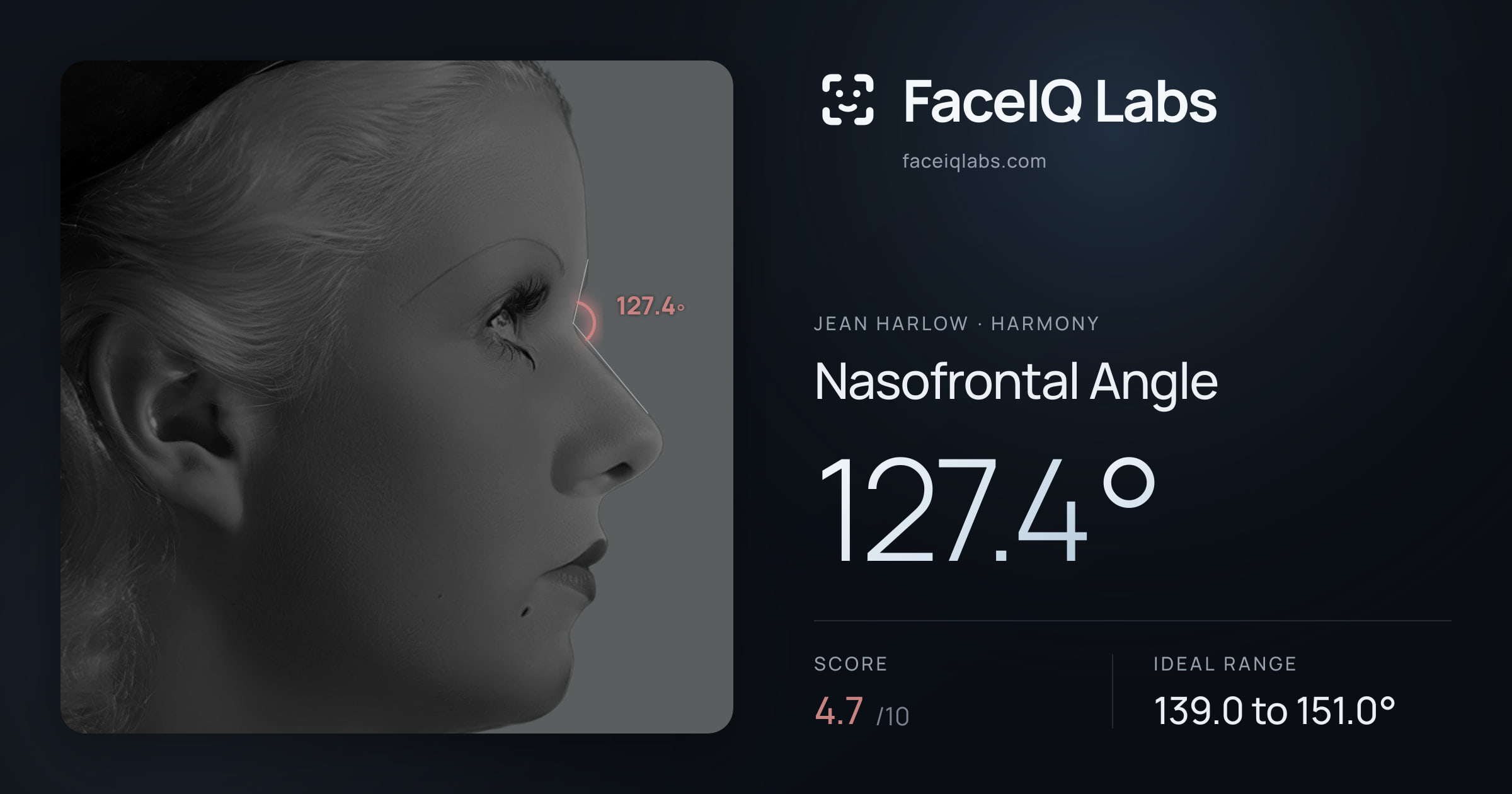 Jean Harlow Nasofrontal Angle: 127.4°, drawn on the photo