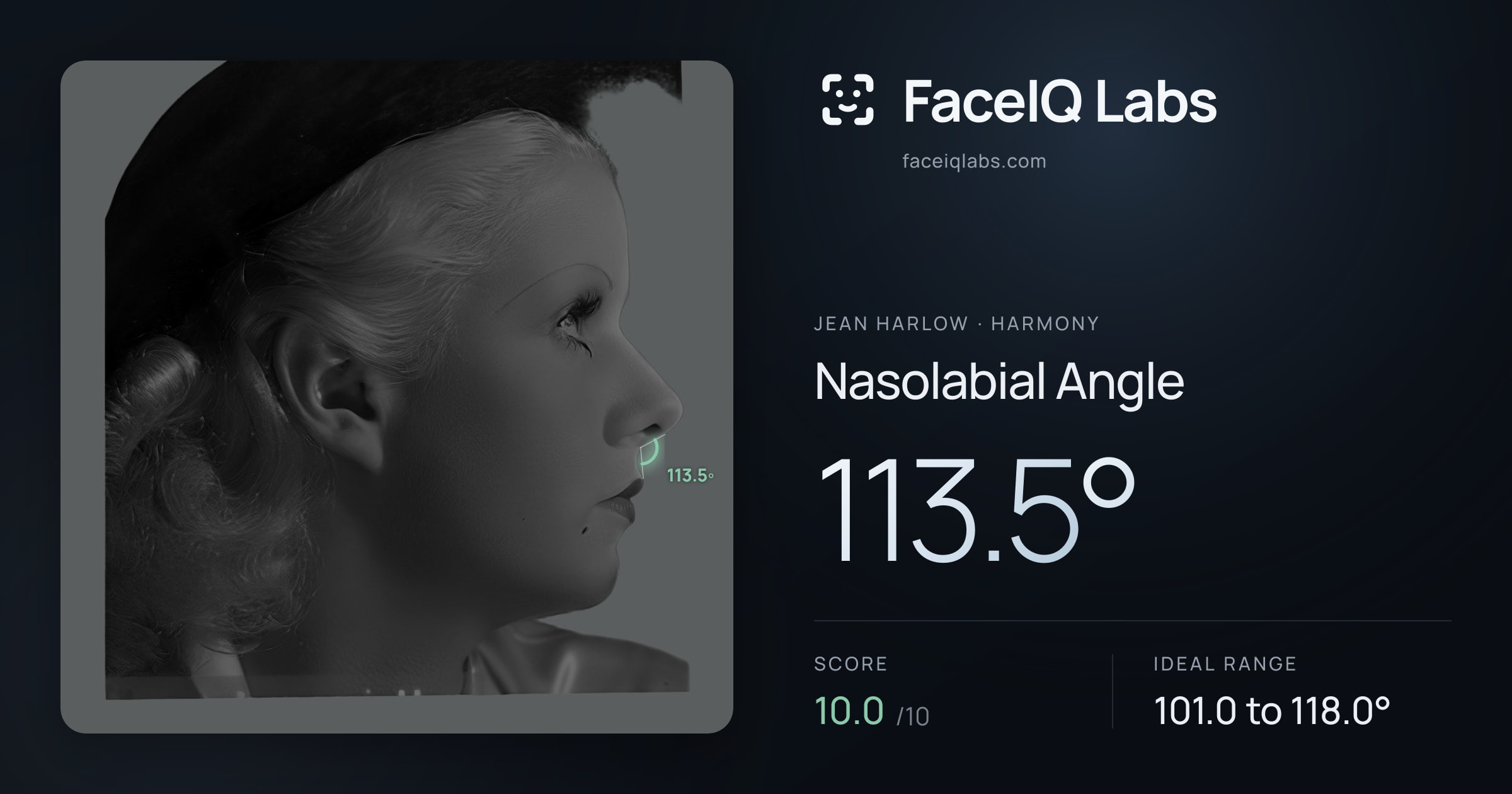 Jean Harlow Nasolabial Angle: 113.5°, drawn on the photo