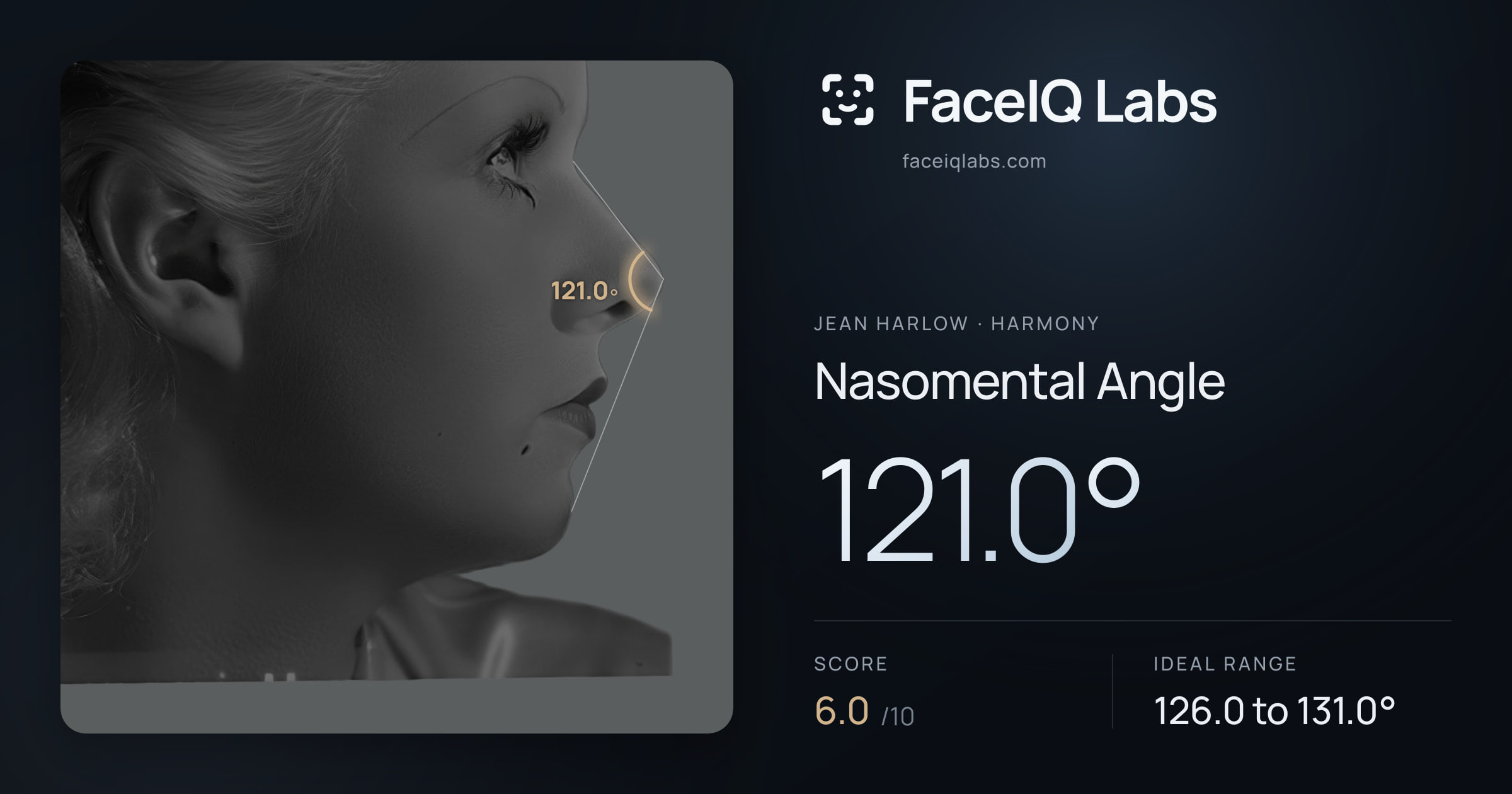 Jean Harlow Nasomental Angle: 121.0°, drawn on the photo