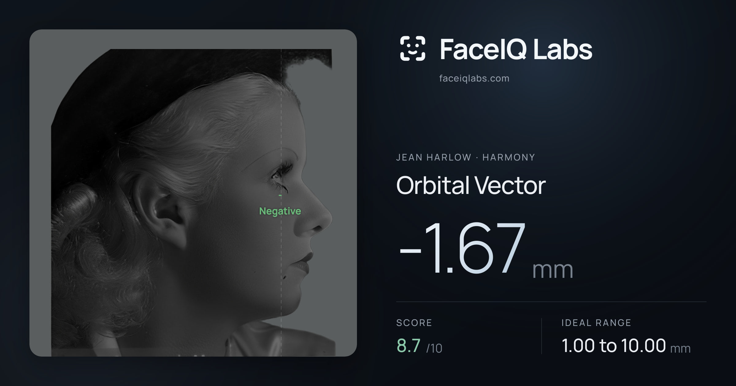 Jean Harlow Orbital Vector: -1.67mm, drawn on the photo