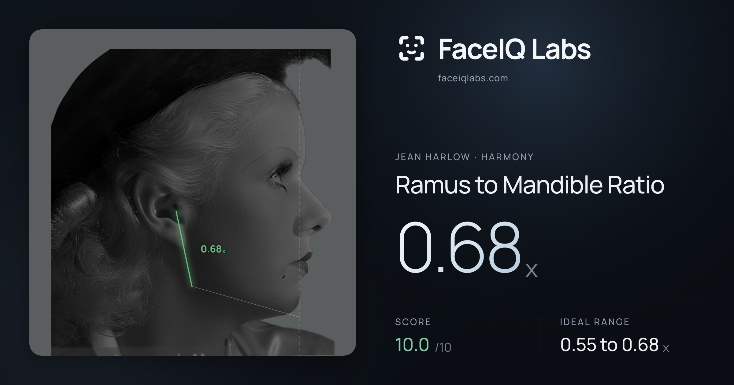Jean Harlow Ramus to Mandible Ratio: 0.68x, drawn on the photo