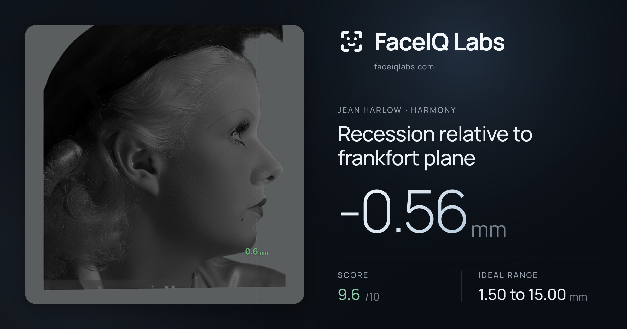 Jean Harlow Recession relative to frankfort plane: -0.56mm, drawn on the photo