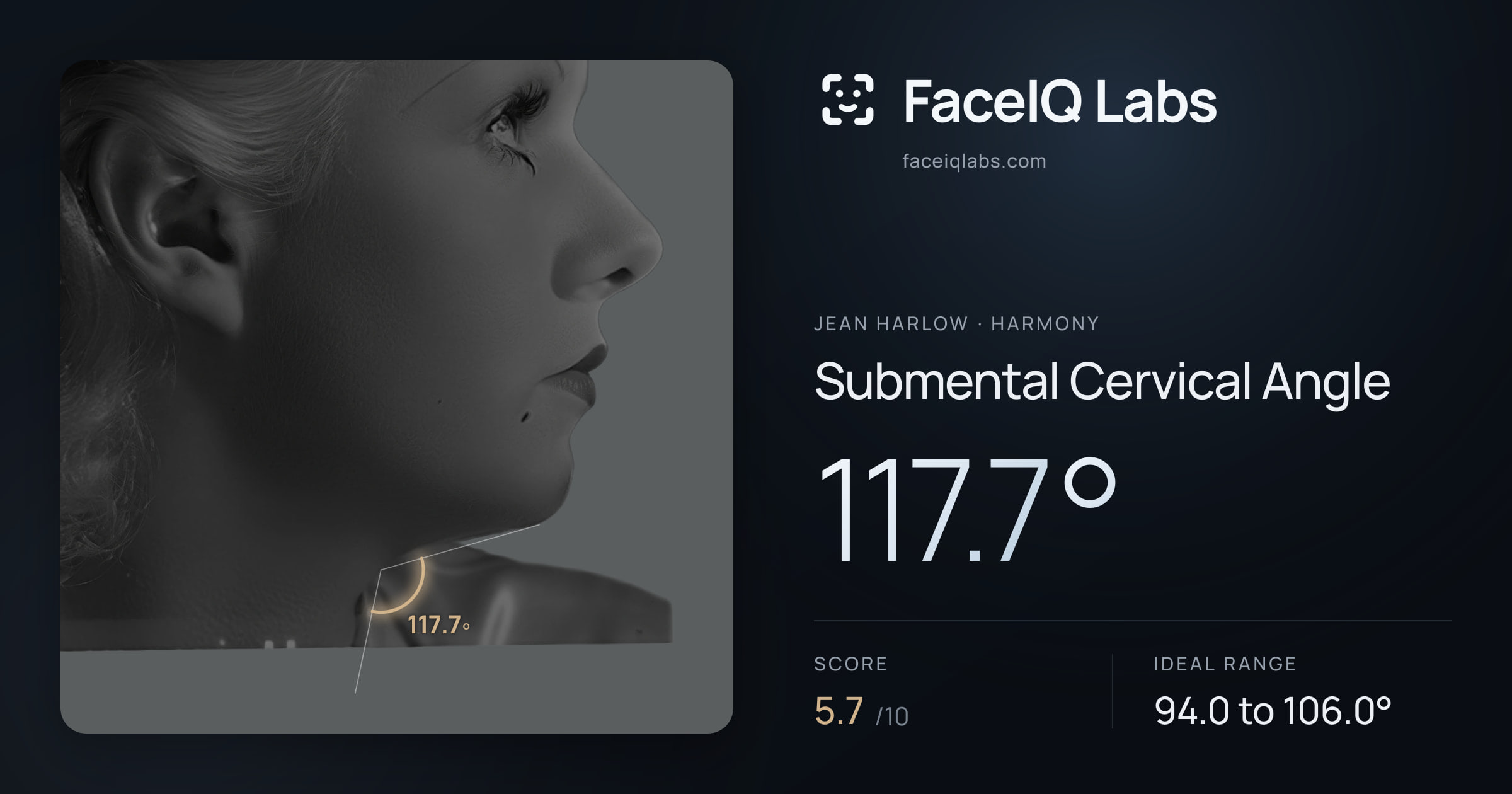 Jean Harlow Submental Cervical Angle: 117.7°, drawn on the photo