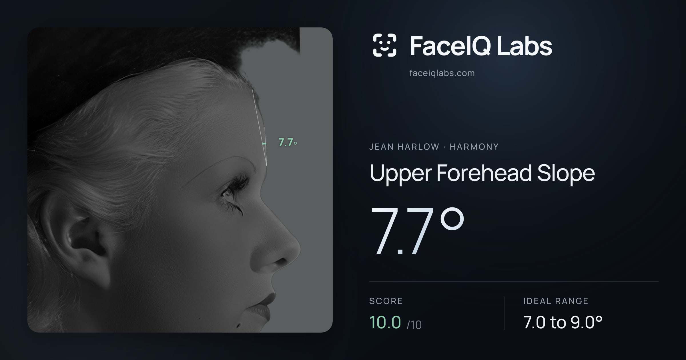 Jean Harlow Upper Forehead Slope: 7.7°, drawn on the photo