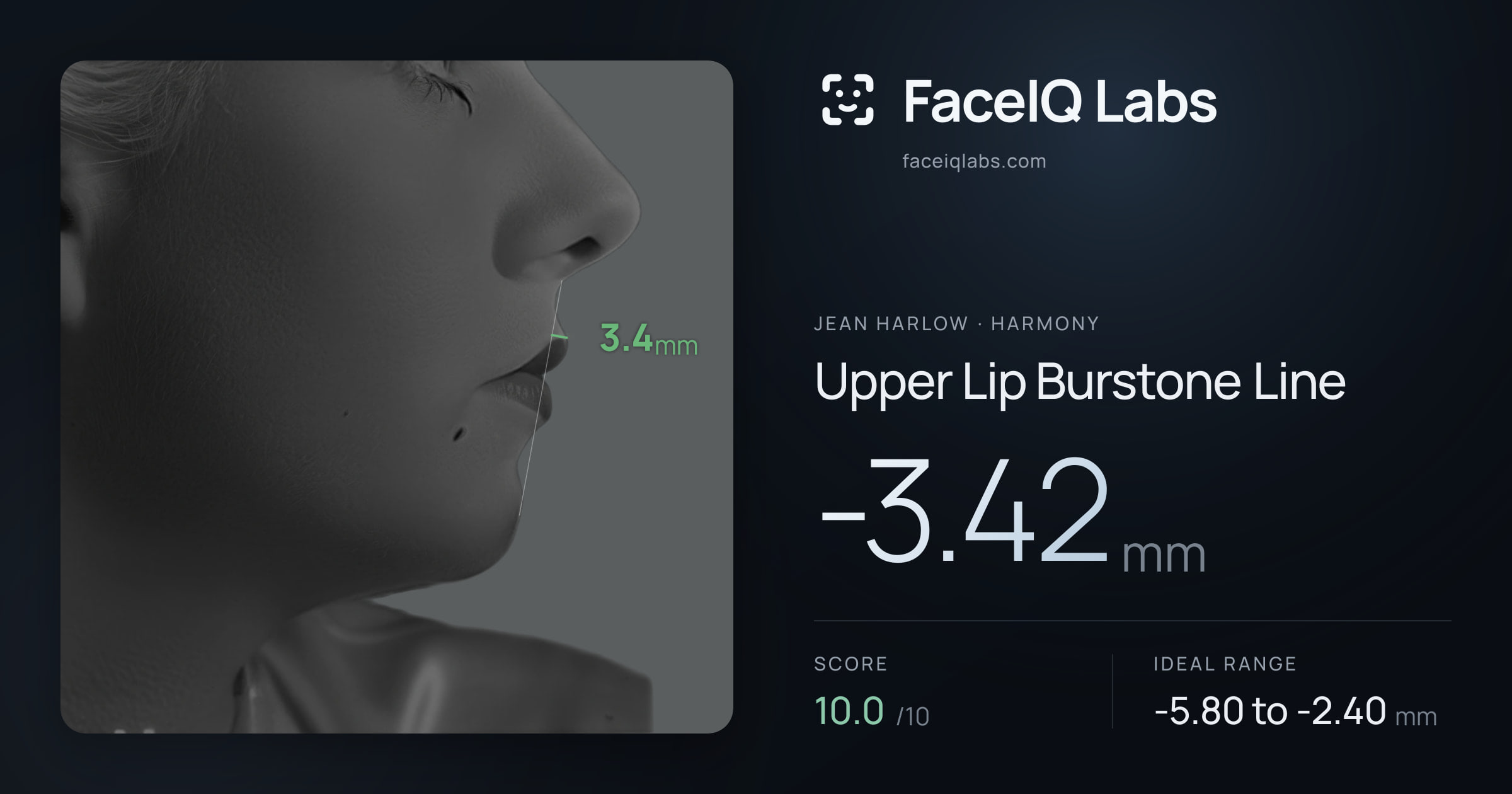 Jean Harlow Upper Lip Burstone Line: -3.42mm, drawn on the photo