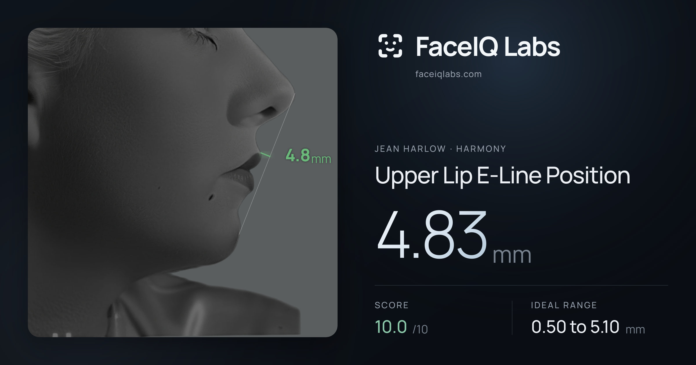 Jean Harlow Upper Lip E-Line Position: 4.83mm, drawn on the photo