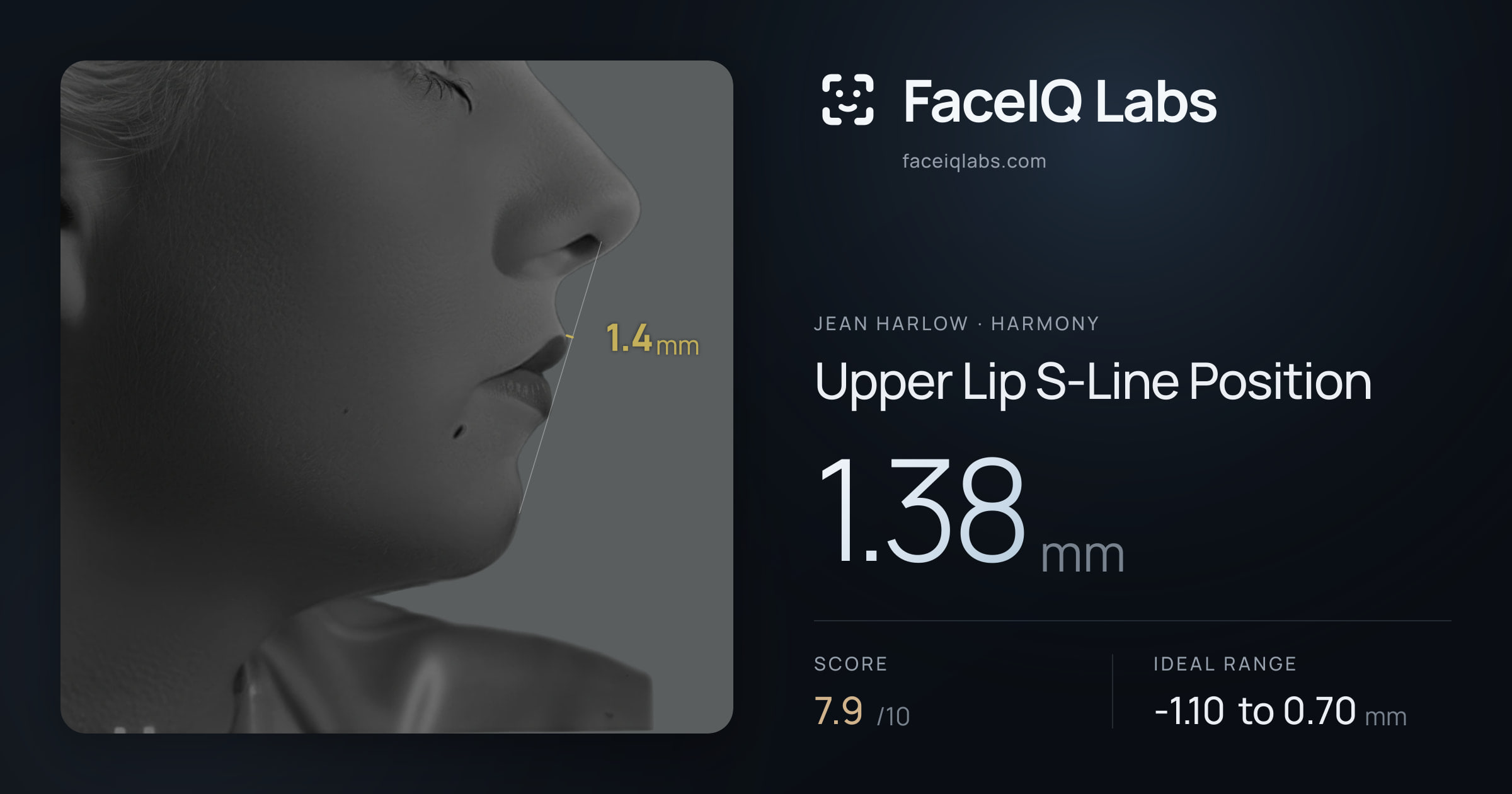 Jean Harlow Upper Lip S-Line Position: 1.38mm, drawn on the photo