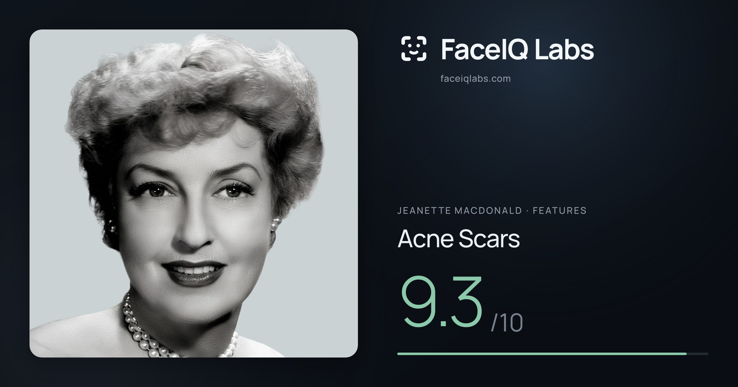 Jeanette MacDonald Acne Scars: 9.3/10, drawn on the photo