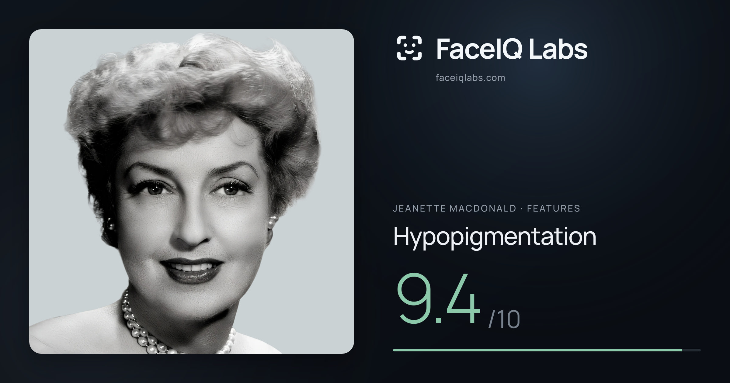 Jeanette MacDonald Hypopigmentation: 9.4/10, drawn on the photo